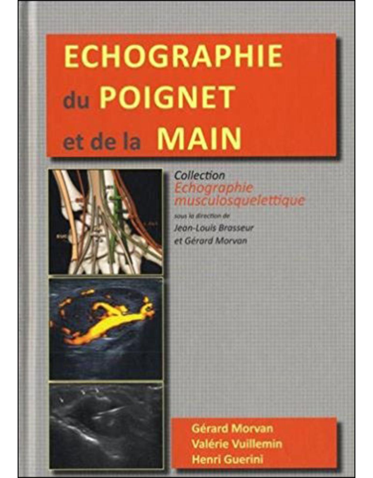 ECHOGRAPHIE DU POIGNET ET DE LA MAIN