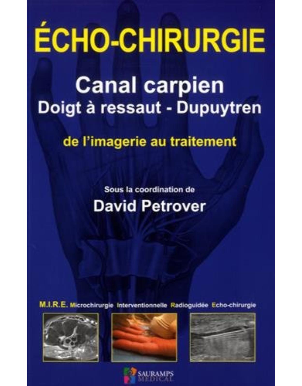 ECHO-CHIRURGIE - CANAL CARPIEN-DOIGT A RESSAUT-DUPUYTREN