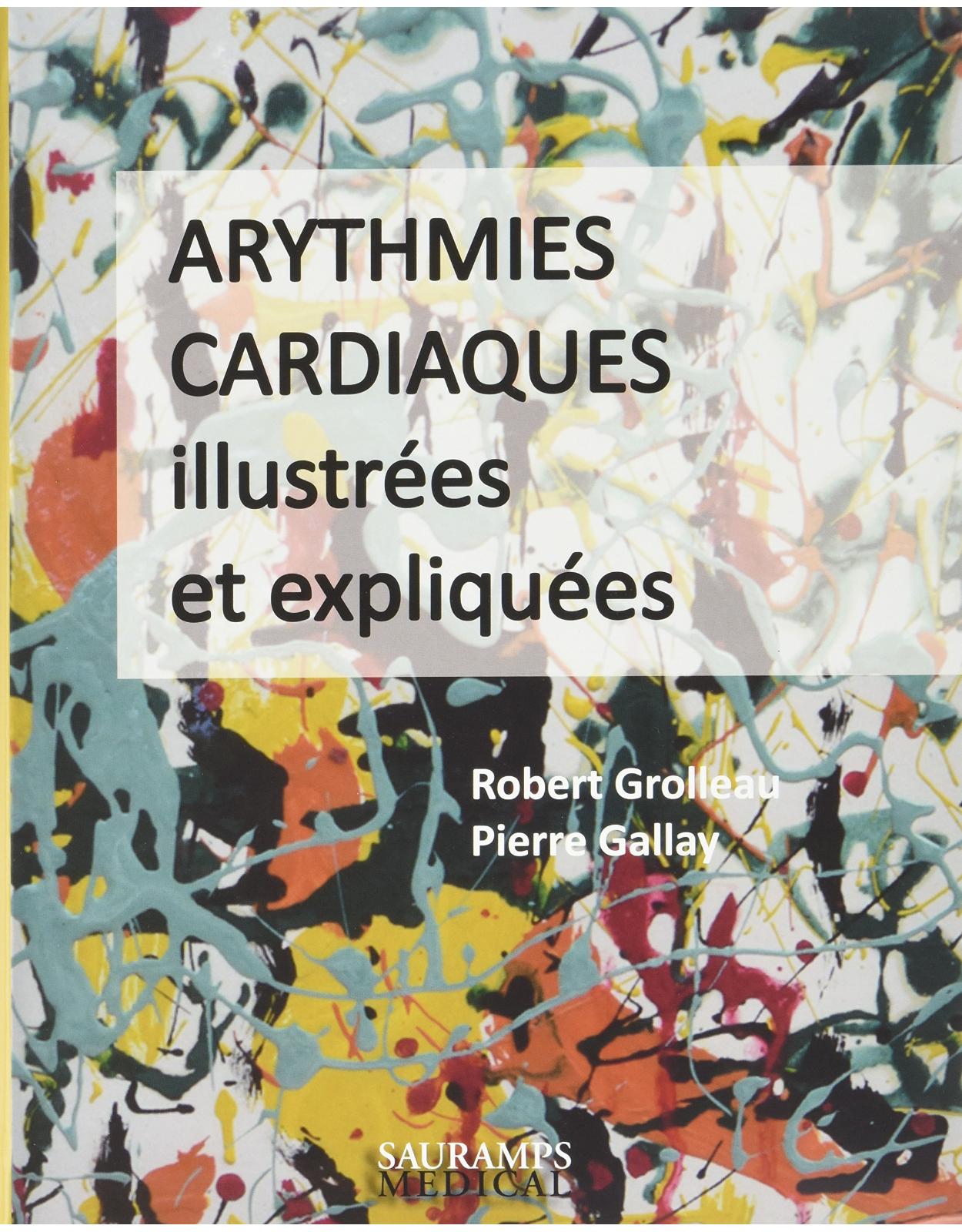 ARYTHMIES CARDIAQUES ILLUSTREES ET EXPLIQUEES