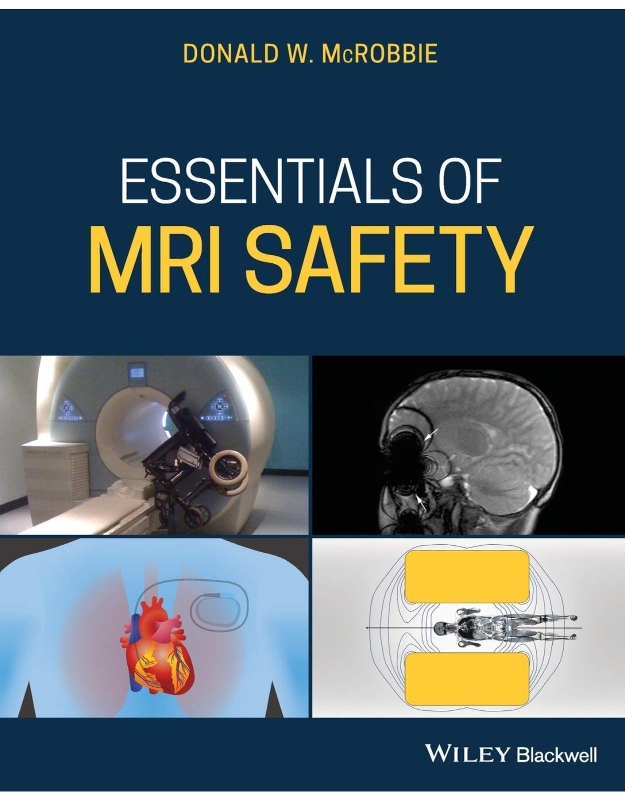 Essentials of MRI Safety