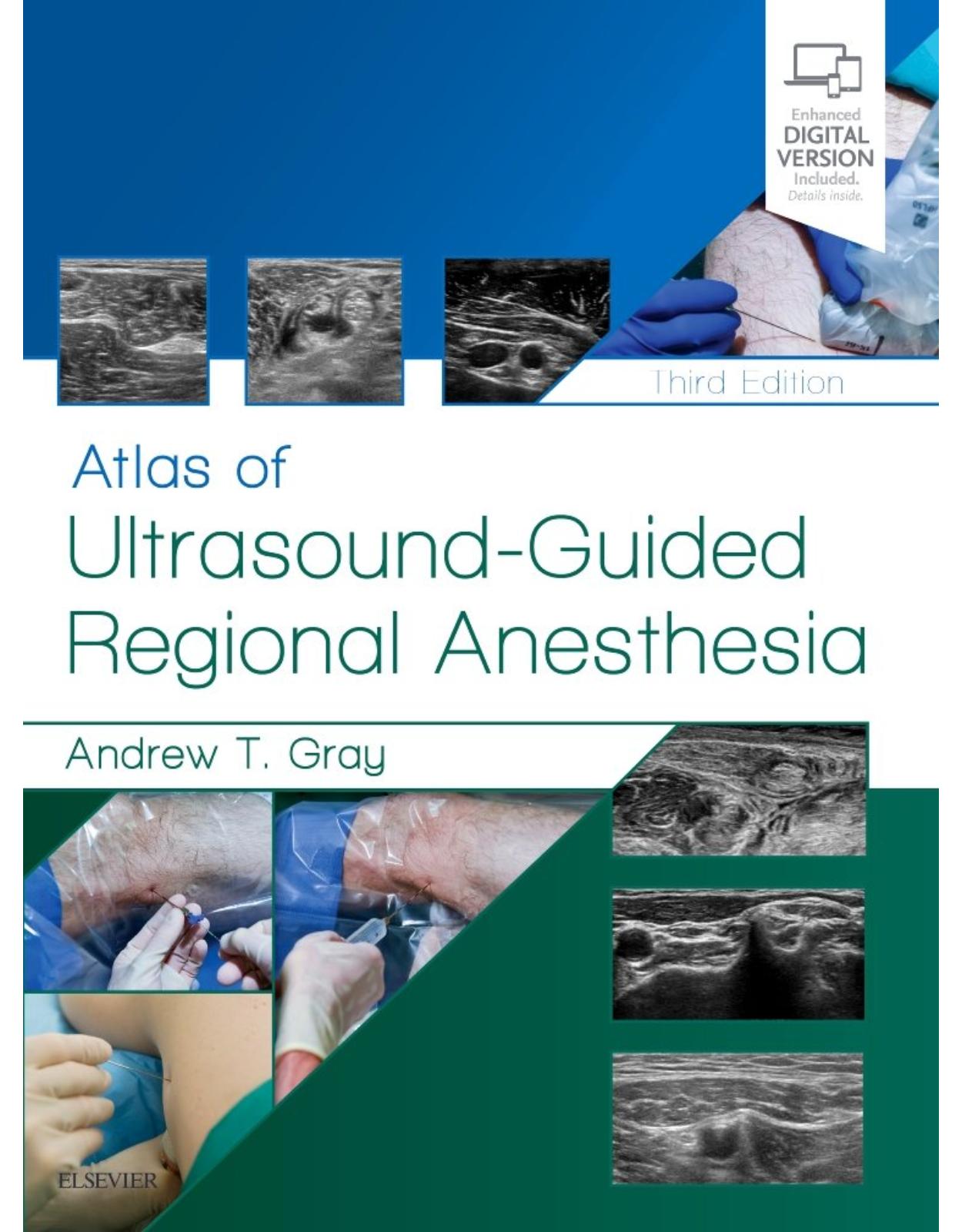 Atlas of Ultrasound-Guided Regional Anesthesia, 3e: Expert Consult - Online and Print