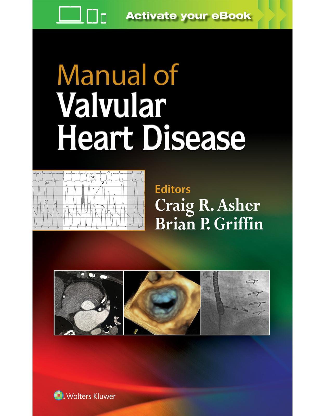 Manual of Valvular Heart Disease