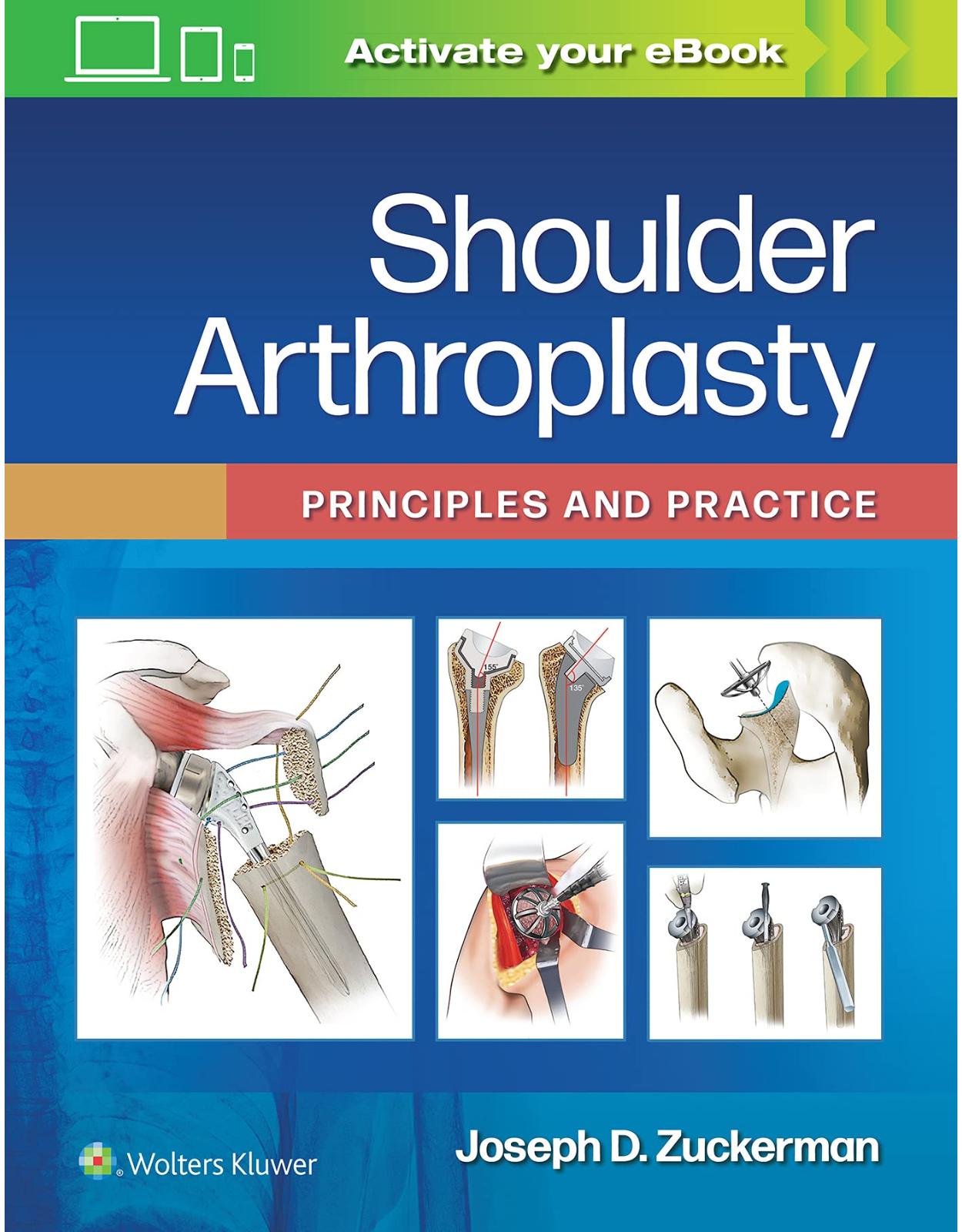 Shoulder Arthroplasty: Principles and Practice 