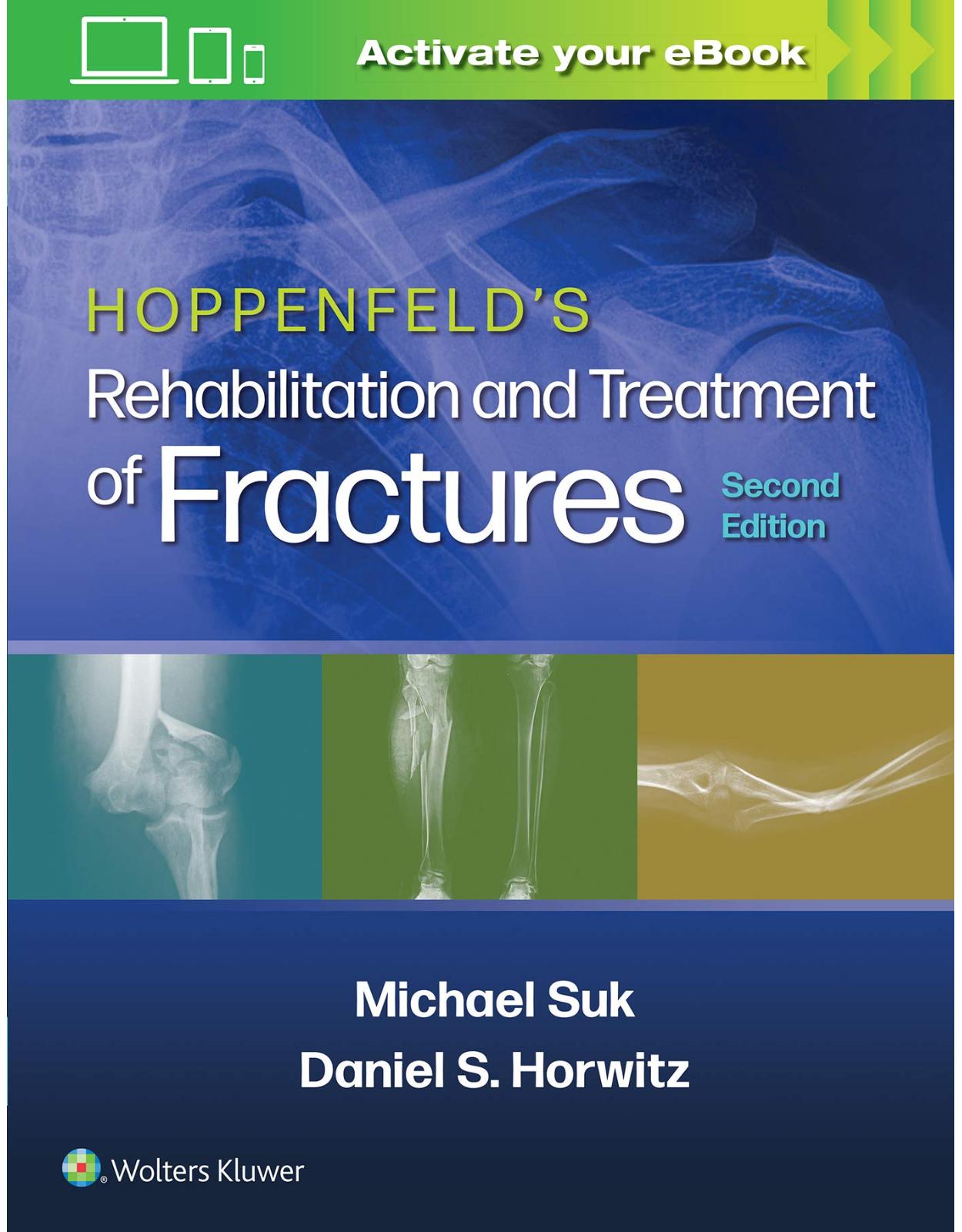 Hoppenfeld's Treatment and Rehabilitation of Fractures