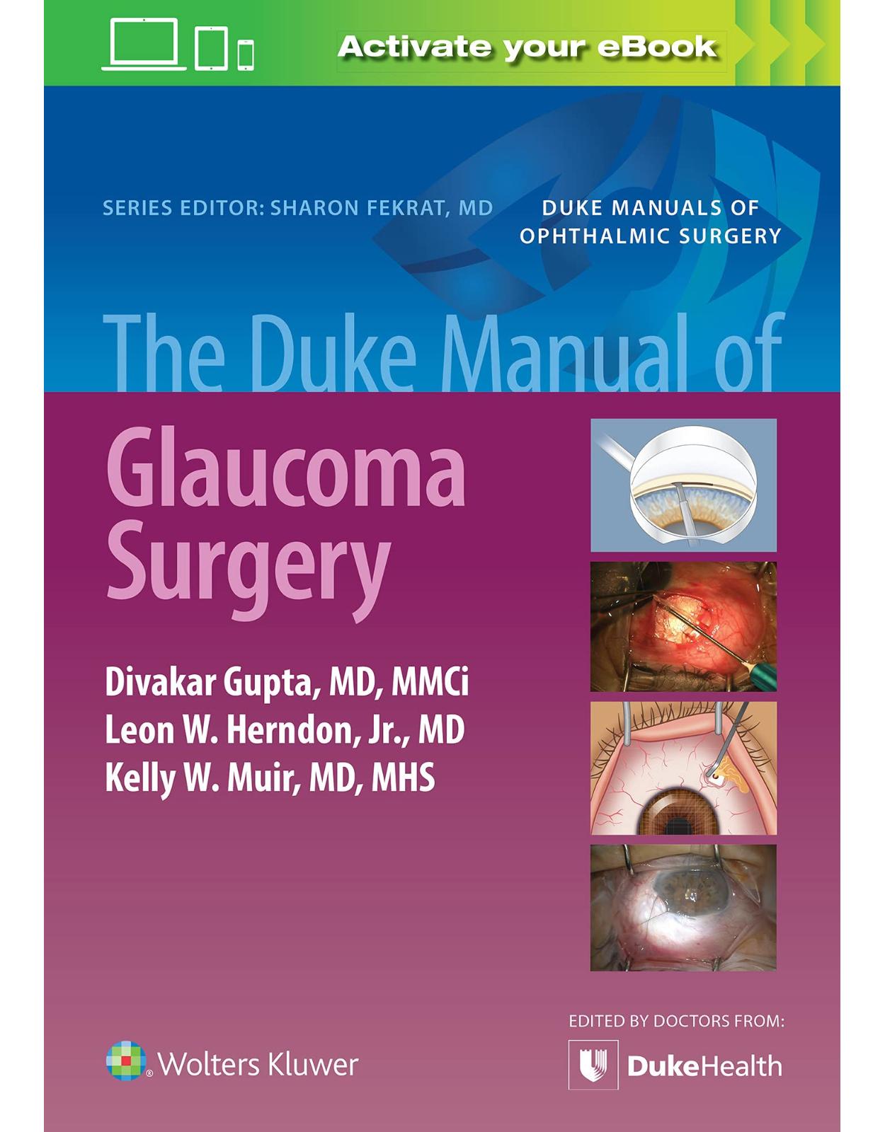  The Duke Manual of Glaucoma Surgery