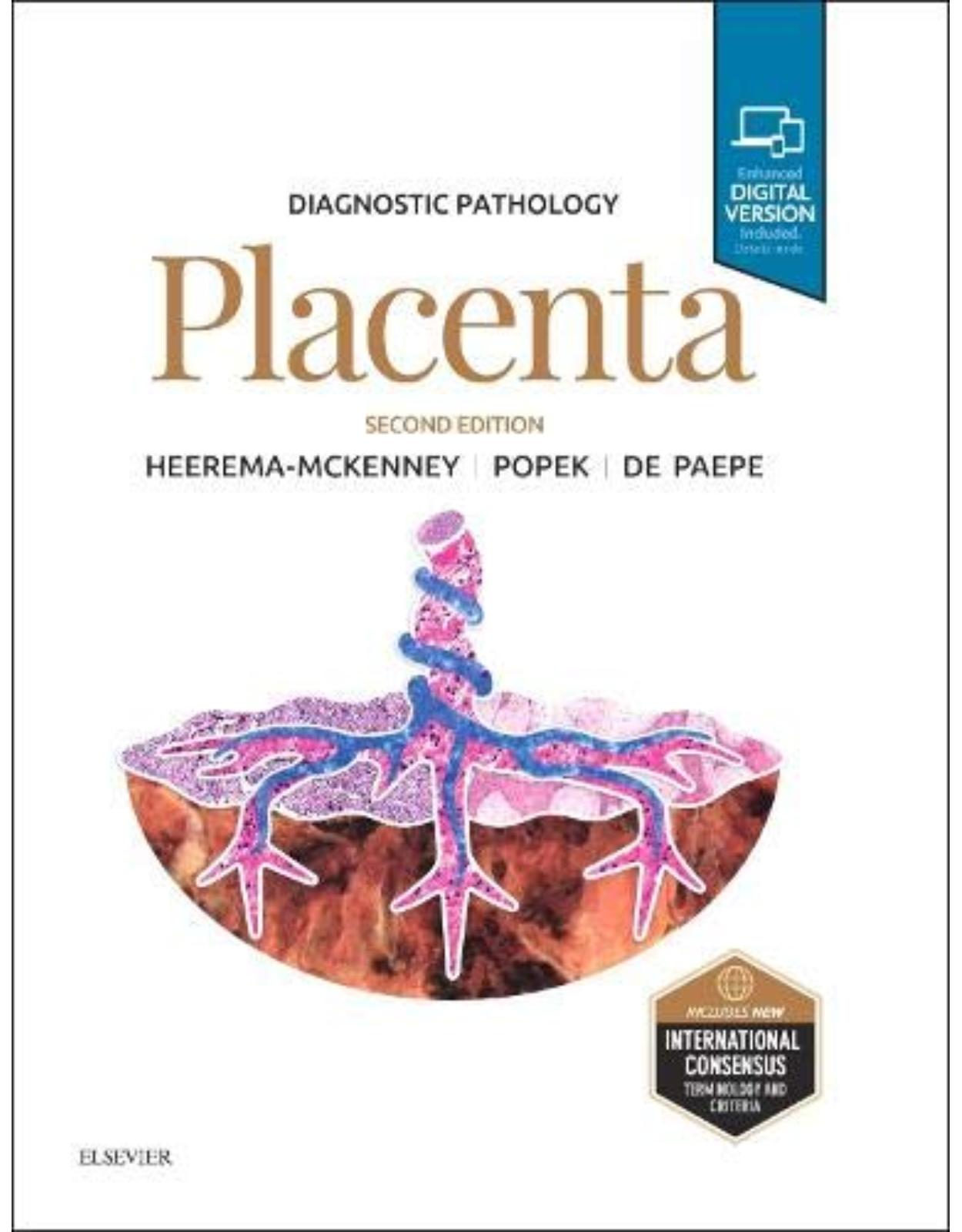 Diagnostic Pathology: Placenta, 2e