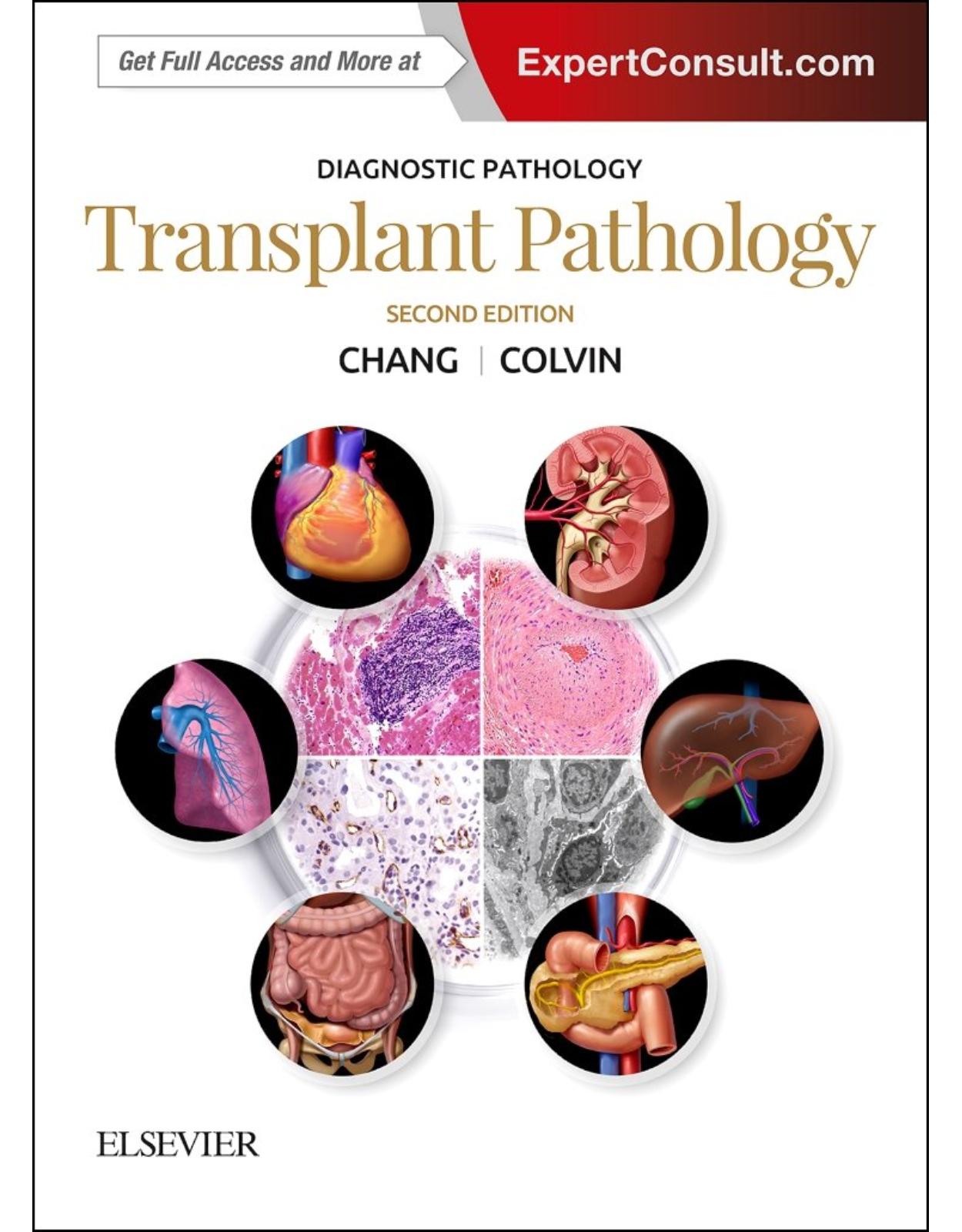 Diagnostic Pathology: Transplant Pathology, 2e