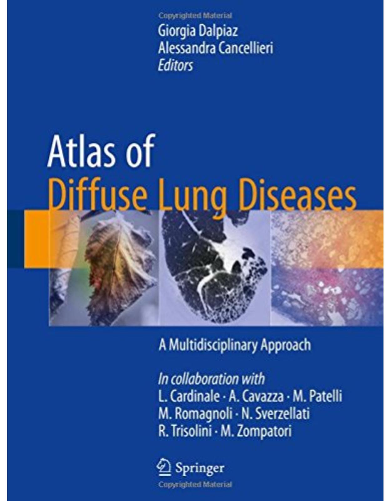 Atlas of Diffuse Lung Diseases