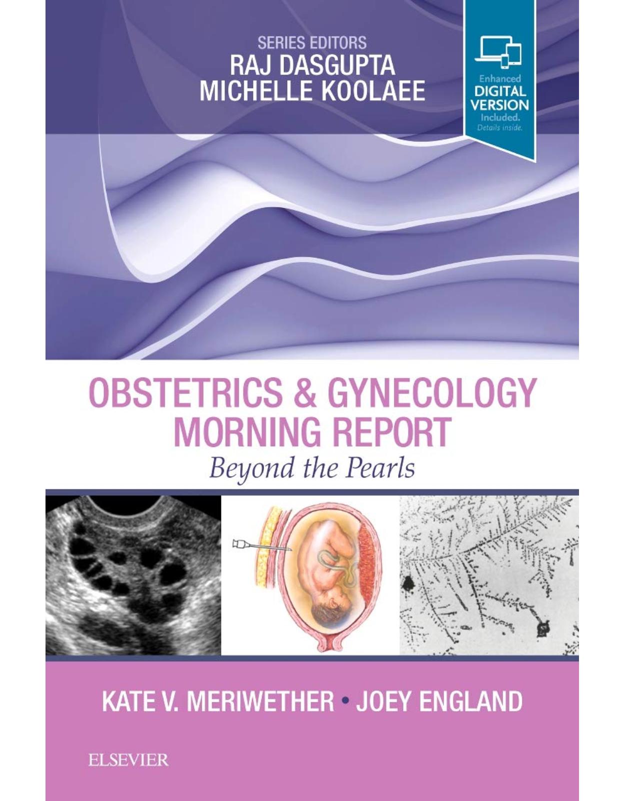 Obstetrics & Gynecology Morning Report: Beyond the Pearls, 1e
