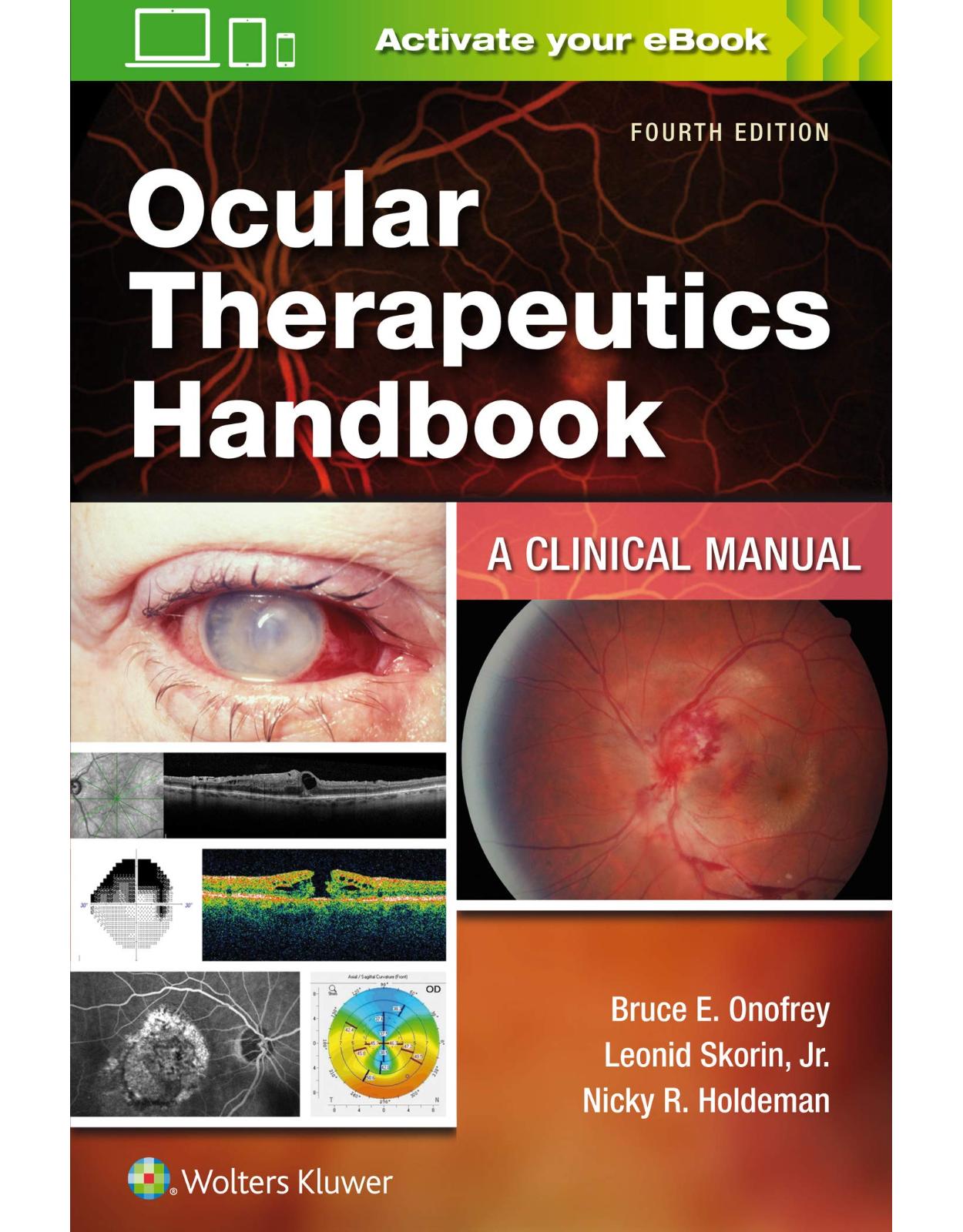 Ocular Therapeutics Handbook: A Clinical Manual