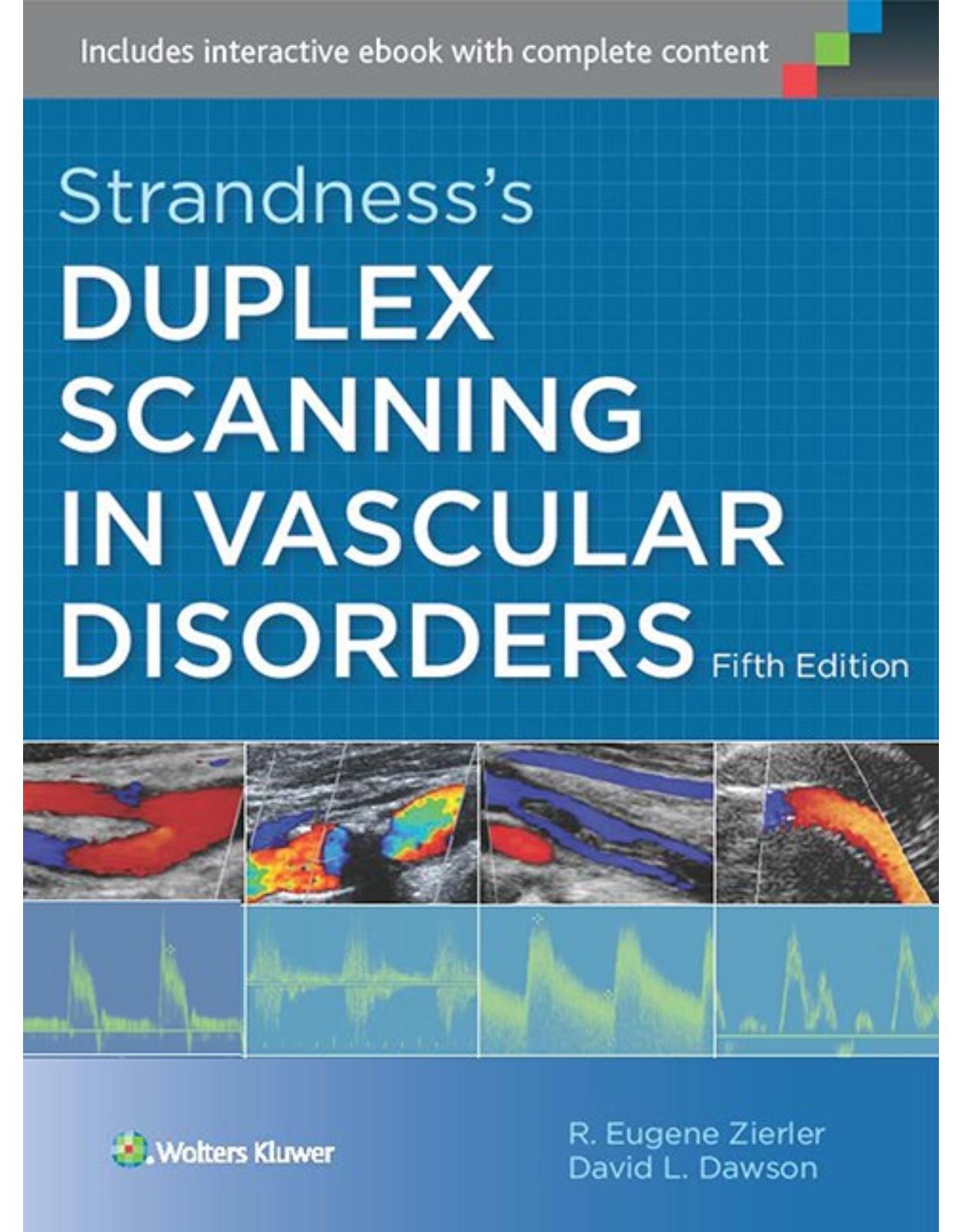 Strandness's Duplex Scanning in Vascular Disorders