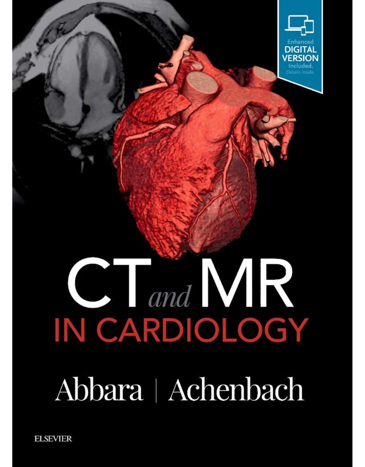 CT and MR in Cardiology, 1e