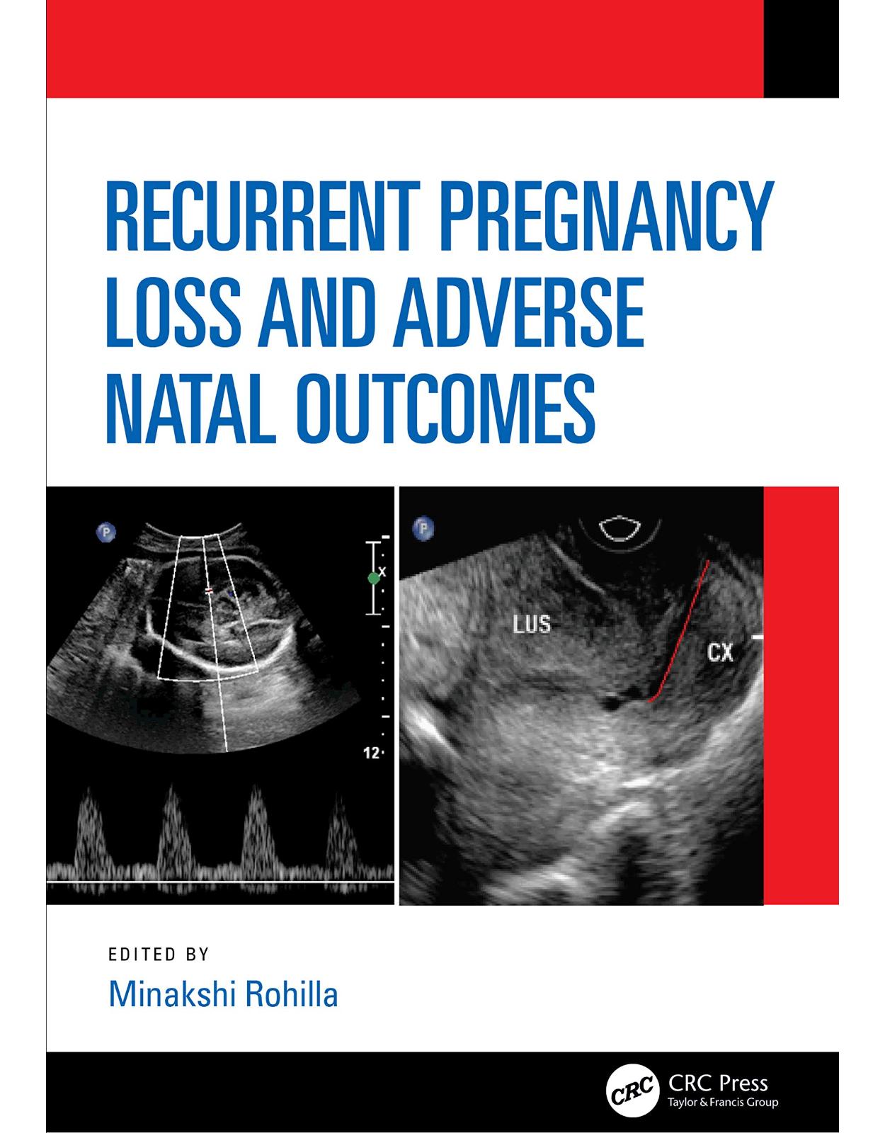 Recurrent Pregnancy Loss and Adverse Natal Outcomes