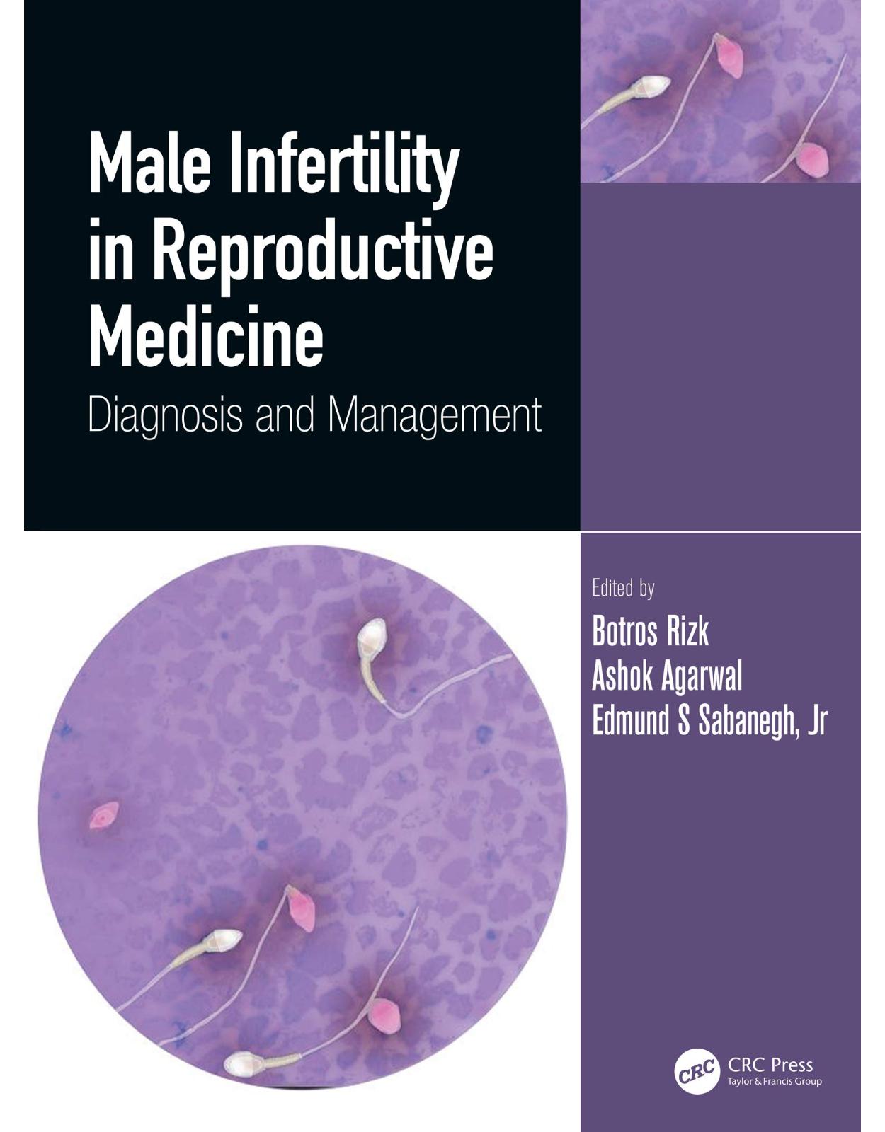 Male Infertility in Reproductive Medicine: Diagnosis and Management