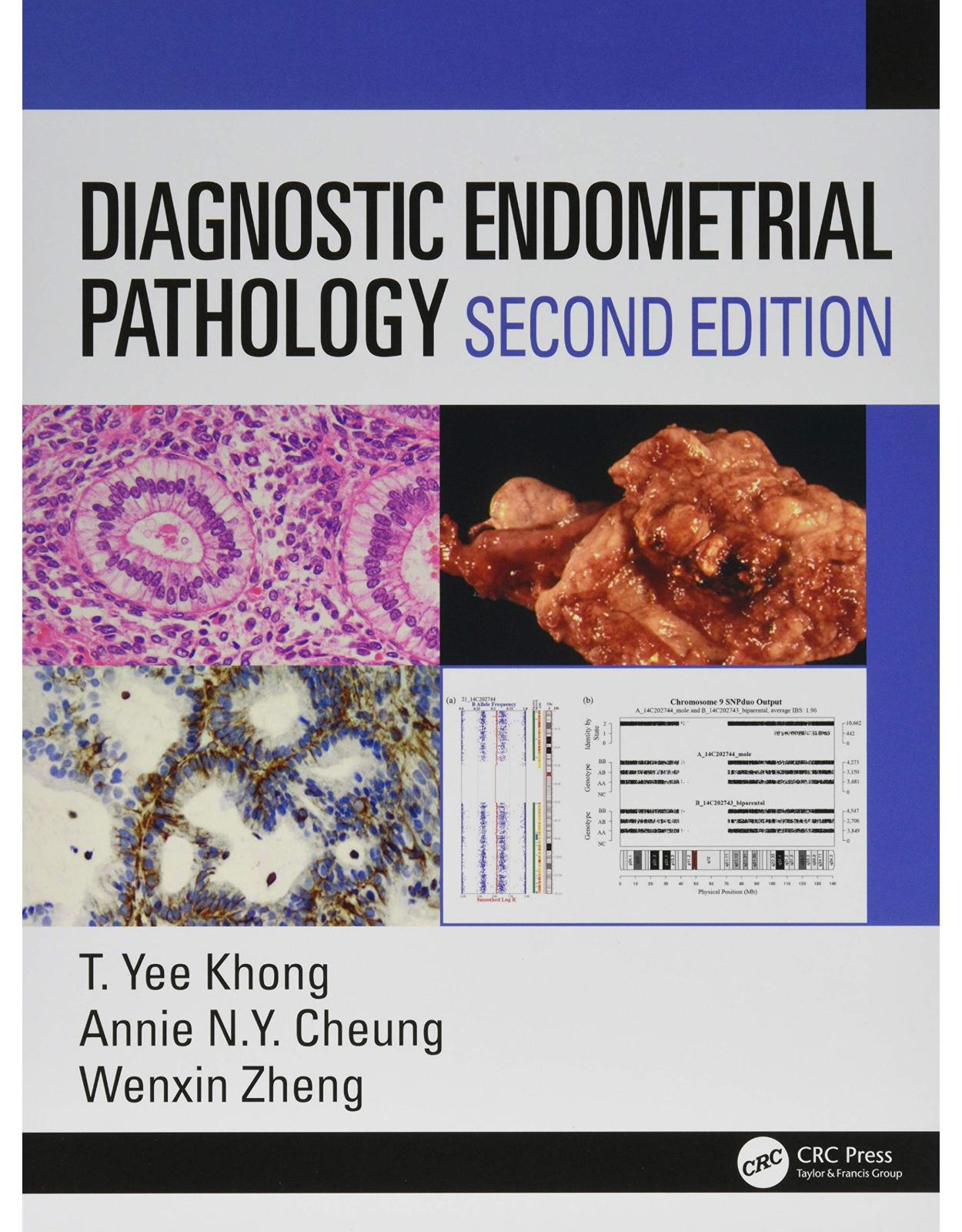 Diagnostic Endometrial Pathology 2E