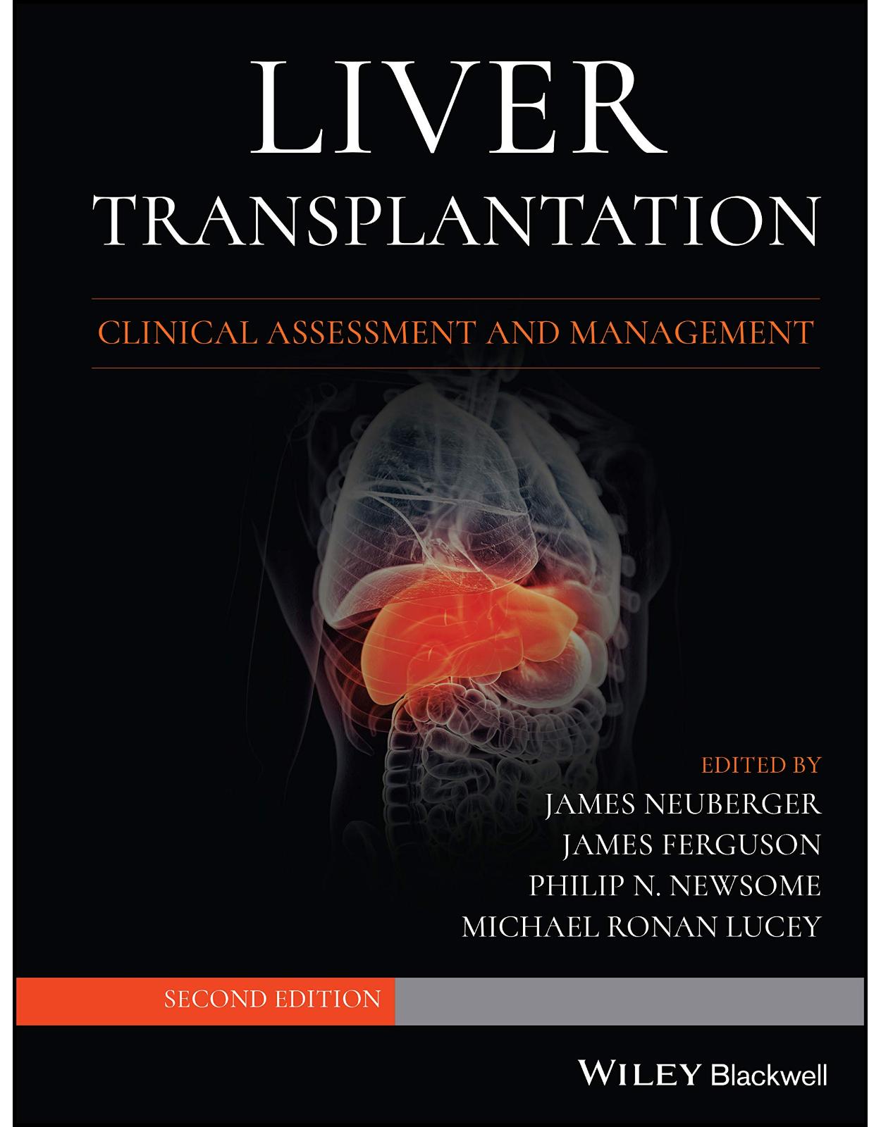 Liver Transplantation: Clinical Assessment and Management