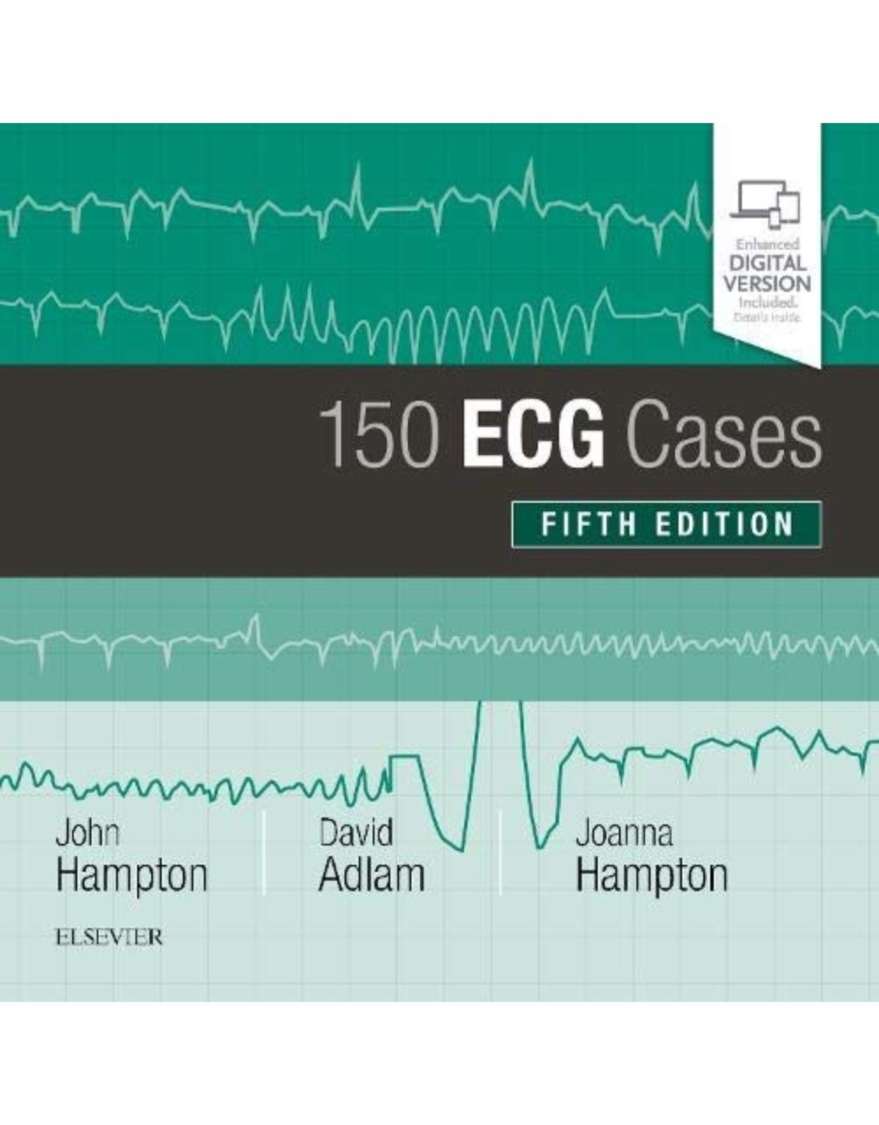 150 ECG Cases, 5e