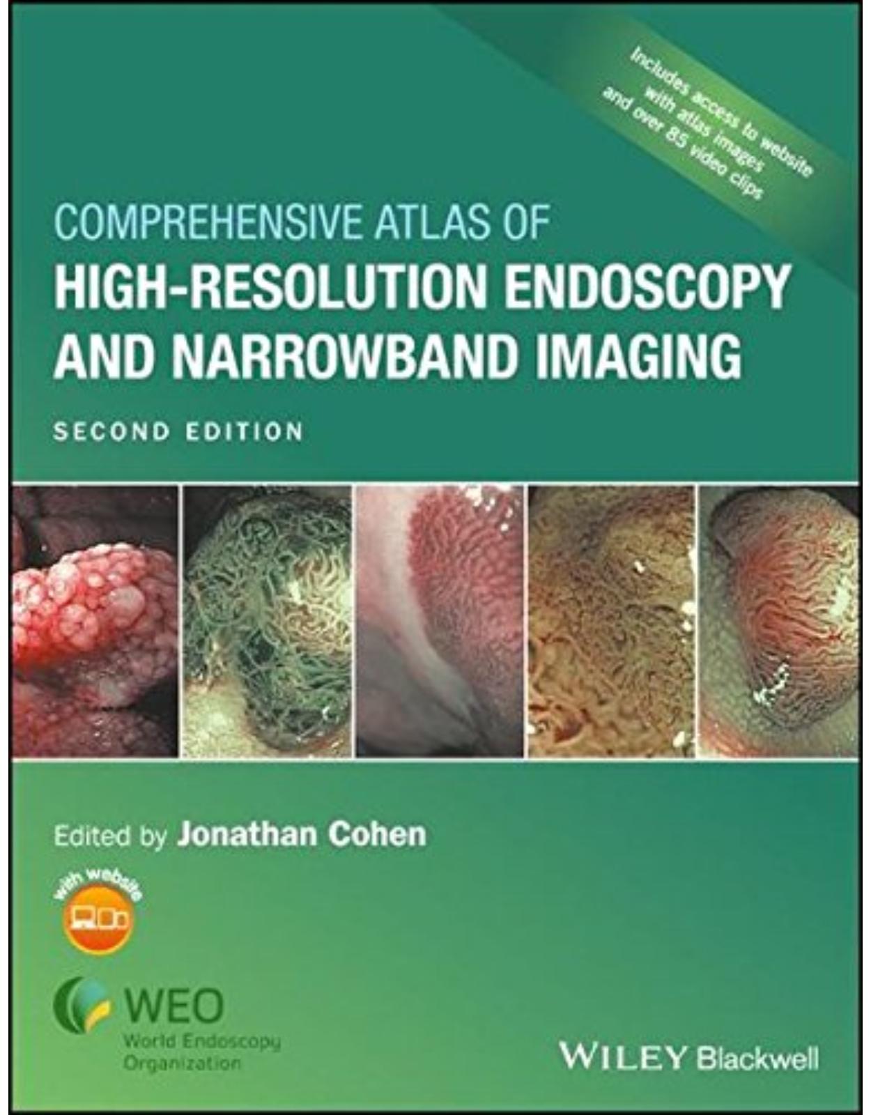 Comprehensive Atlas of High Resolution Endoscopy and Narrowband Imaging