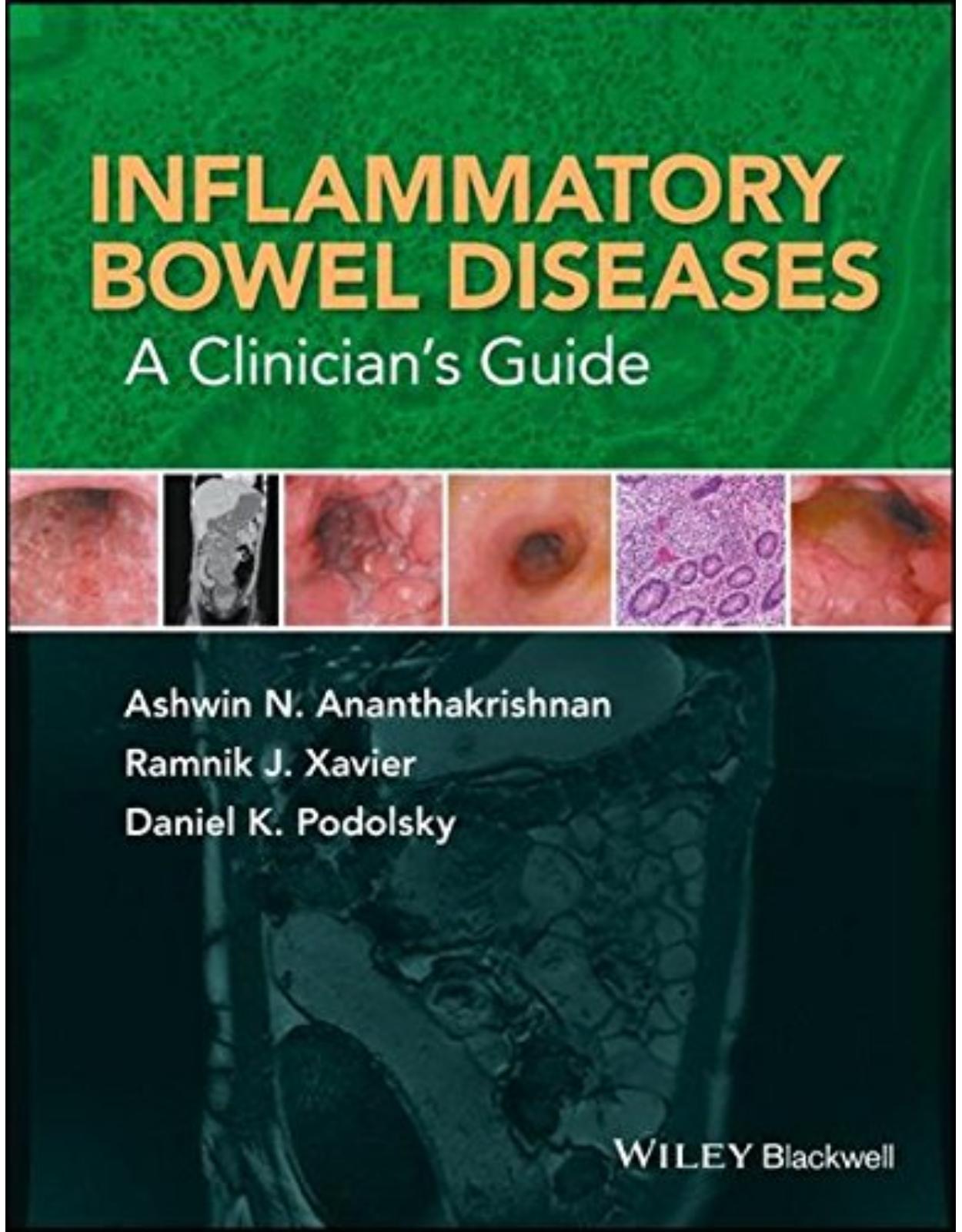 Inflammatory Bowel Diseases: A Clinicians Guide