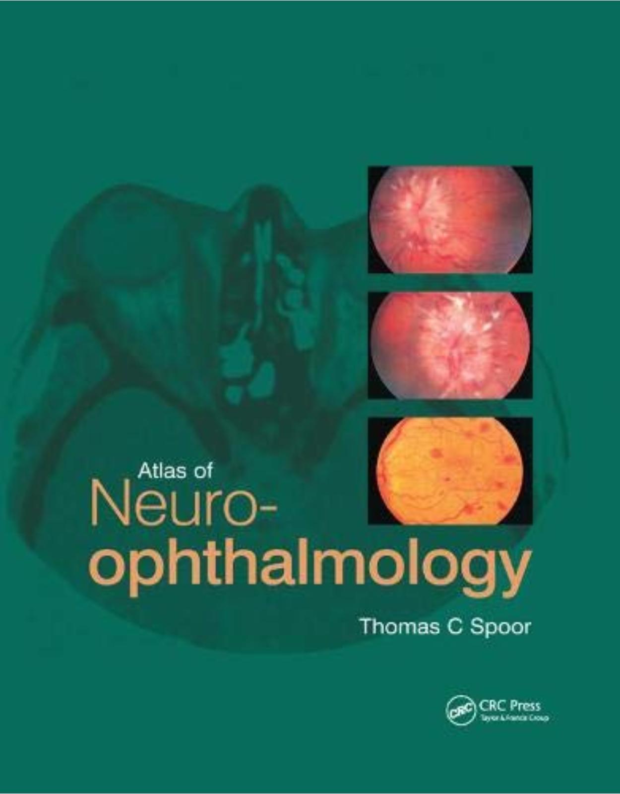 Atlas of Neuro-ophthalmology 