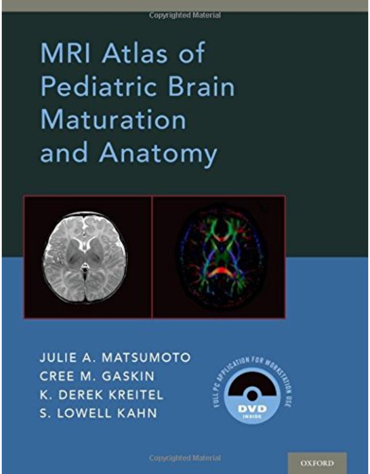 MRI Atlas of Pediatric Brain Maturation and Anatomy