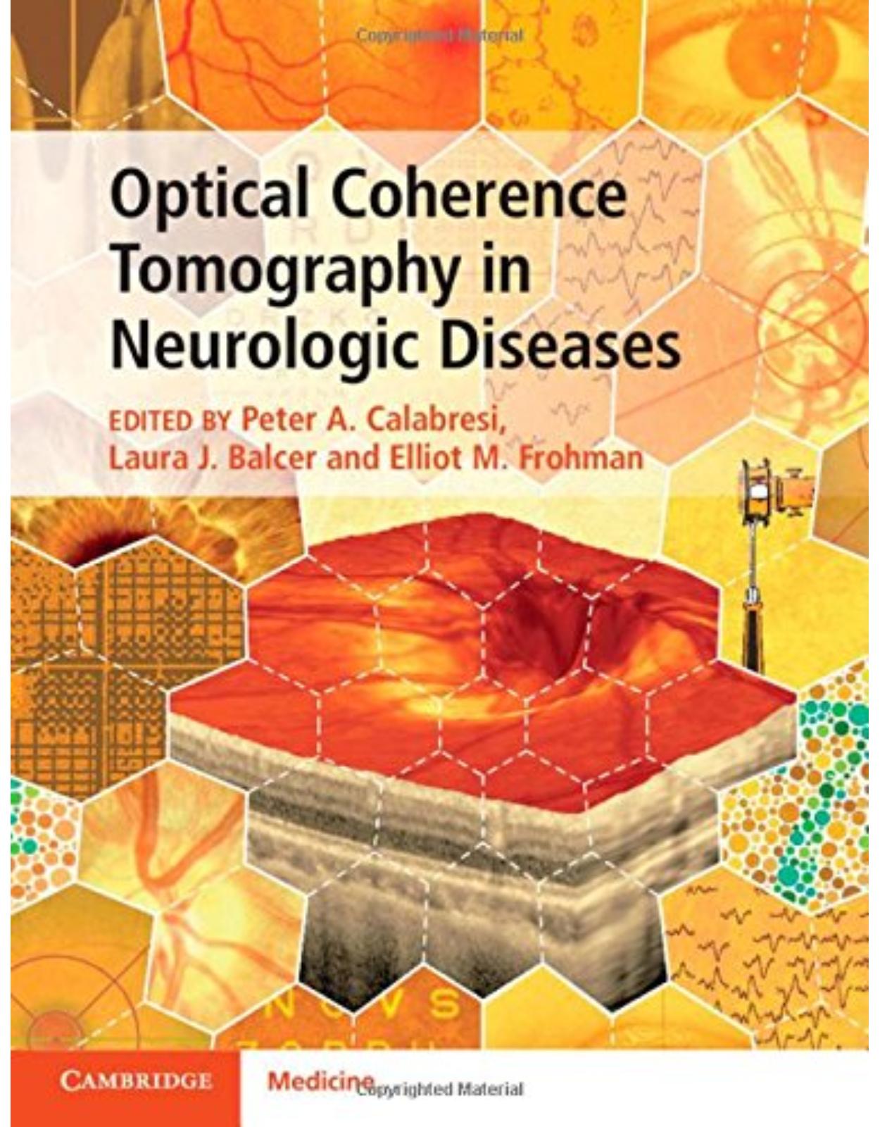 Optical Coherence Tomography in Neurologic Diseases