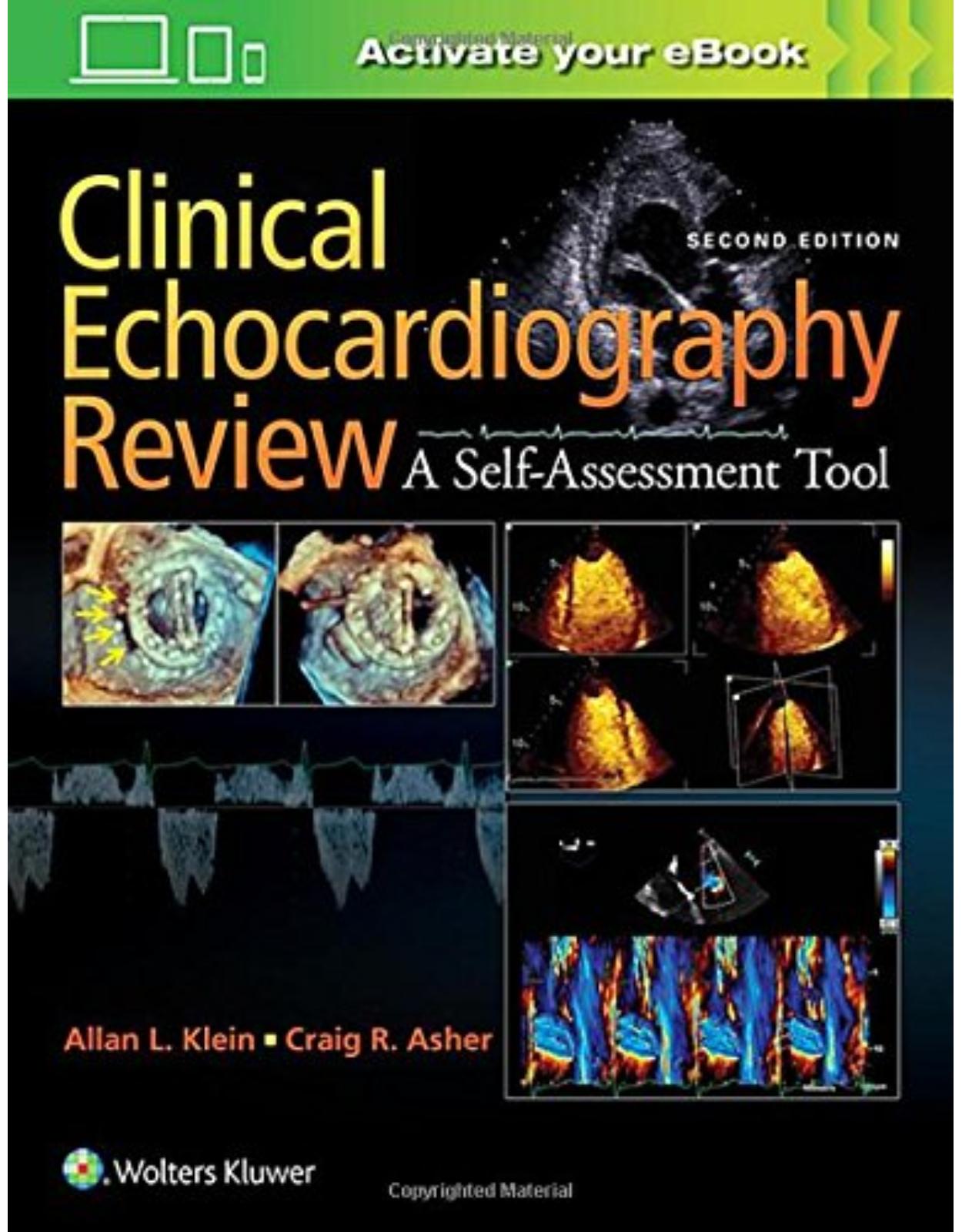 Clinical Echocardiography Review, 2e 