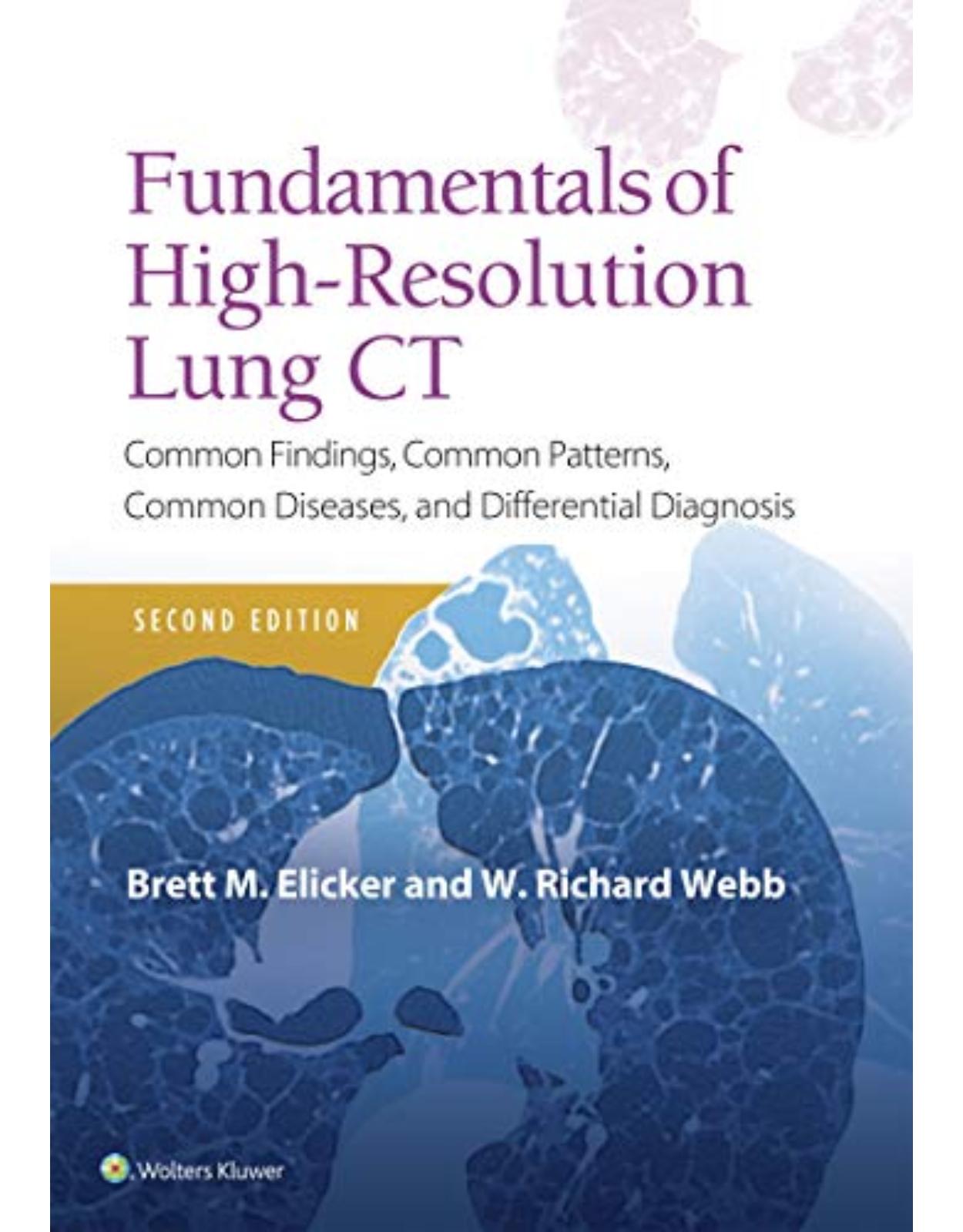 Fundamentals of High-Resolution Lung CT: Common Findings, Common Patterns, Common Diseases and Differential Diagnosis