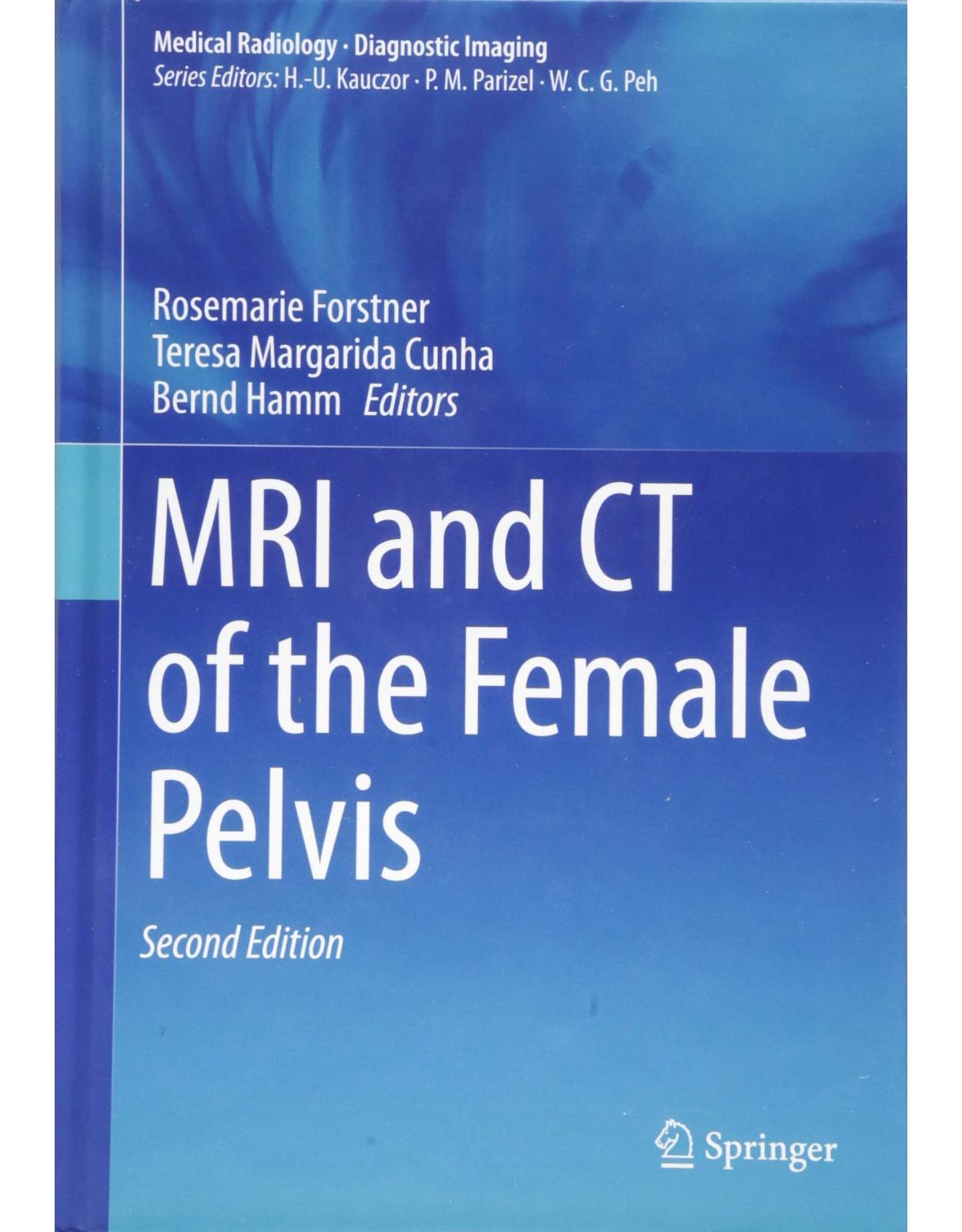 MRI and CT of the Female Pelvis 