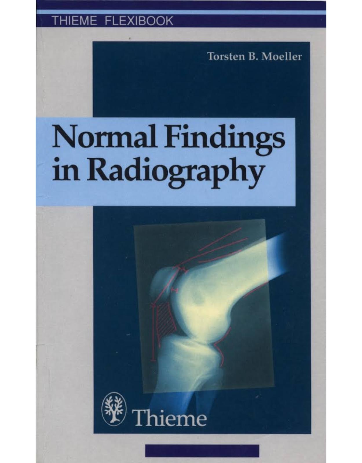 Normal Findings in Radiography