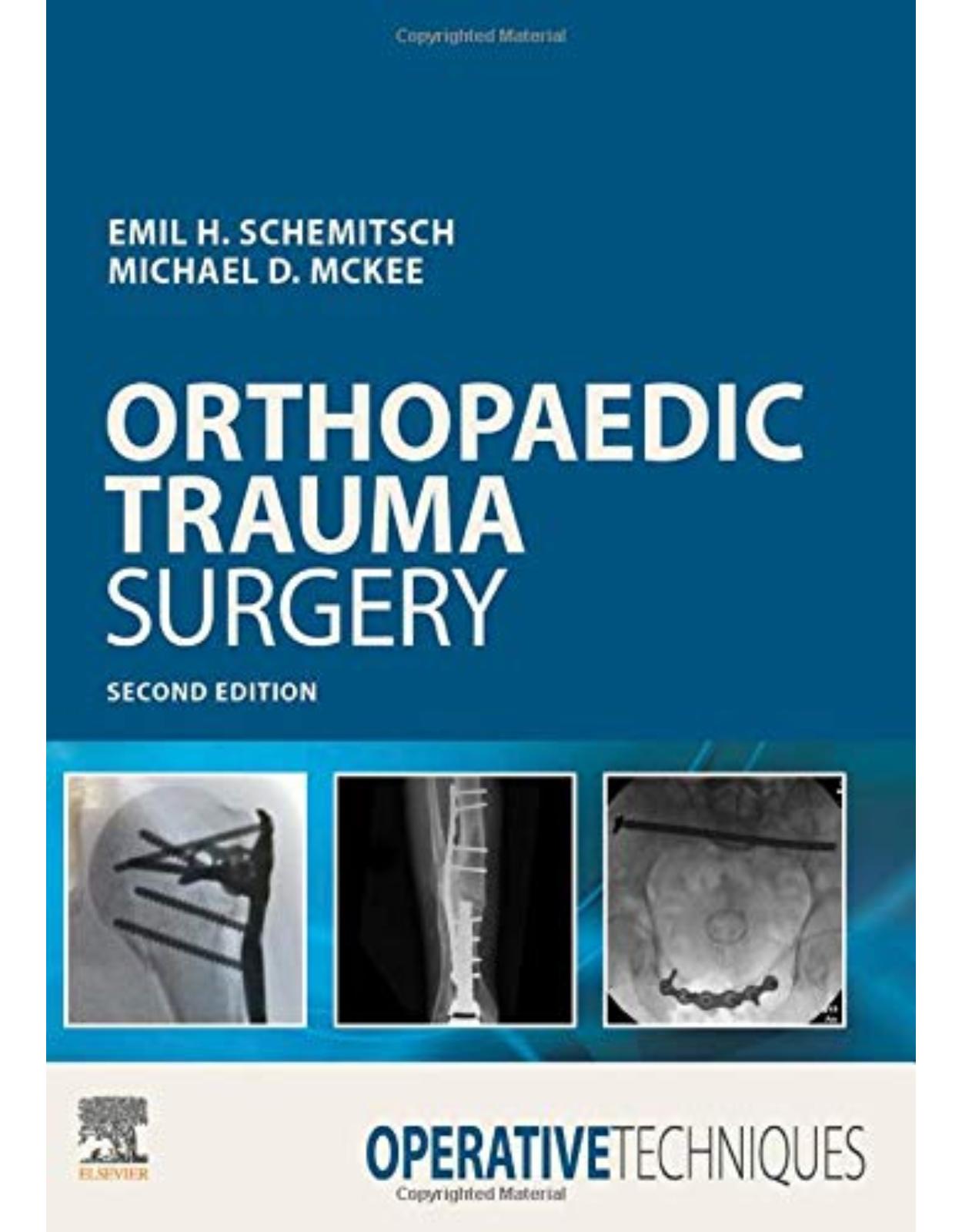 Operative Techniques: Orthopaedic Trauma Surgery, 2nd Edition 