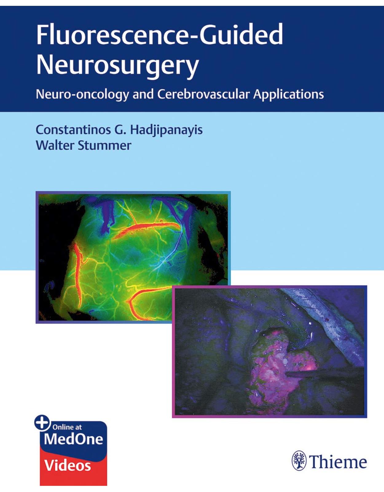 Fluorescence-Guided Neurosurgery: Neuro-oncology and Cerebrovascular Applications 