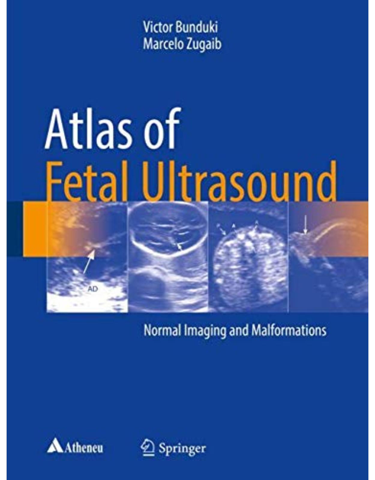 Atlas of Fetal Ultrasound Normal Imaging and Malformations