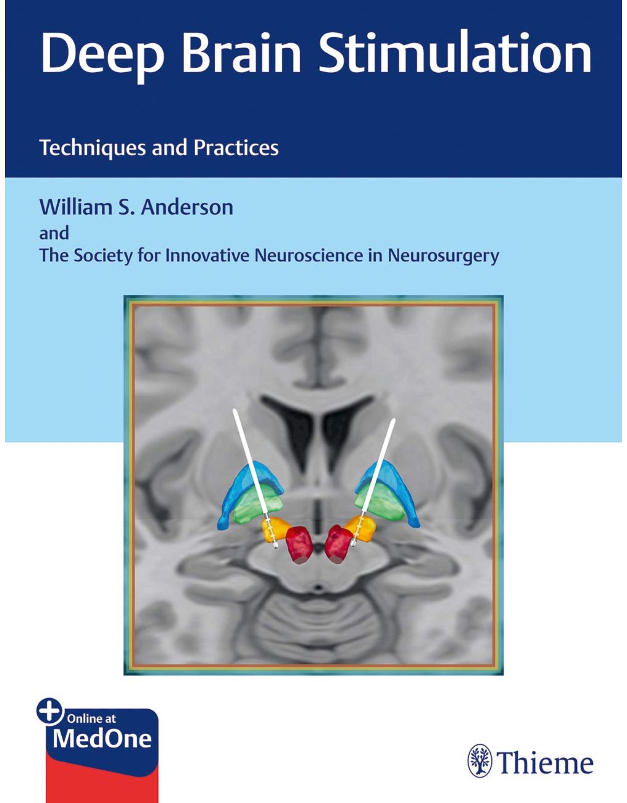 Deep Brain Stimulation: Techniques and Practices