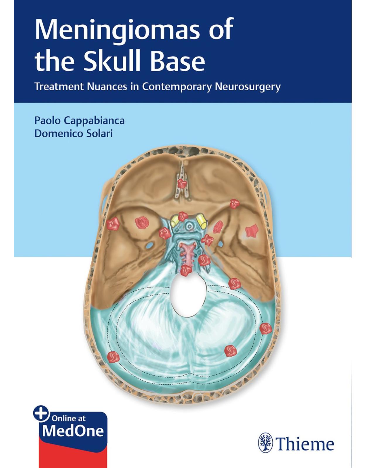 Meningiomas of the Skull Base: Treatment Nuances in Contemporary Neurosurgery 