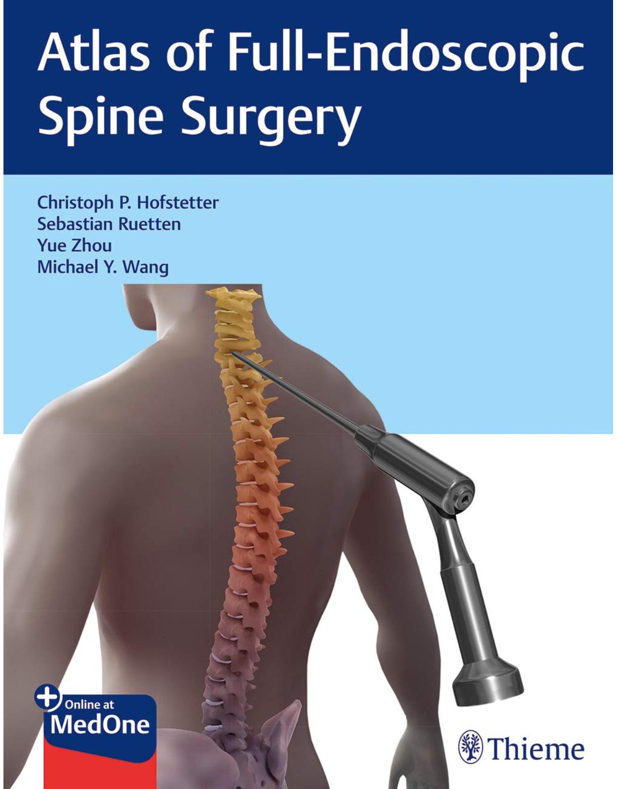 Atlas of Full-Endoscopic Spine Surgery