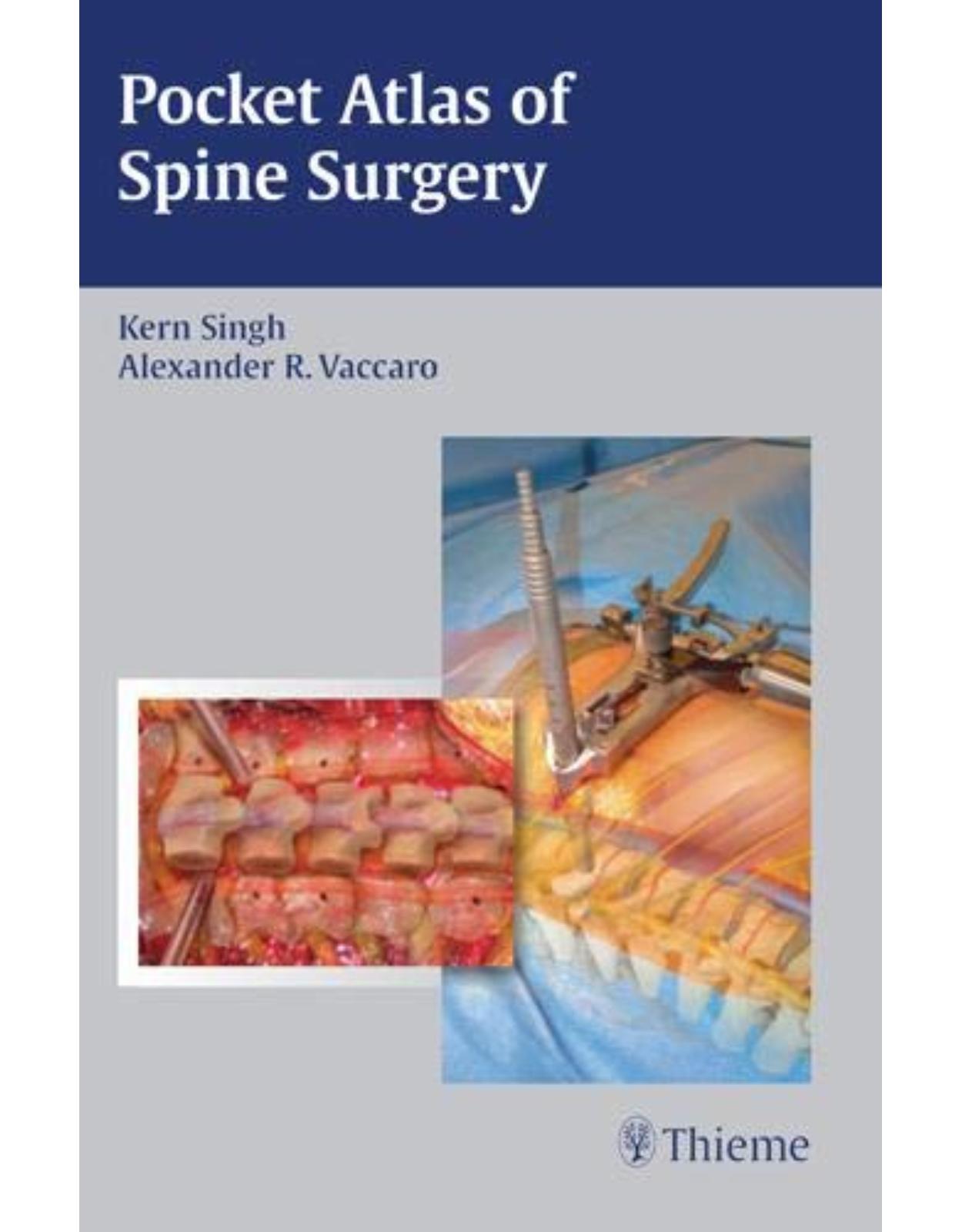 Pocket Atlas of Spine Surgery