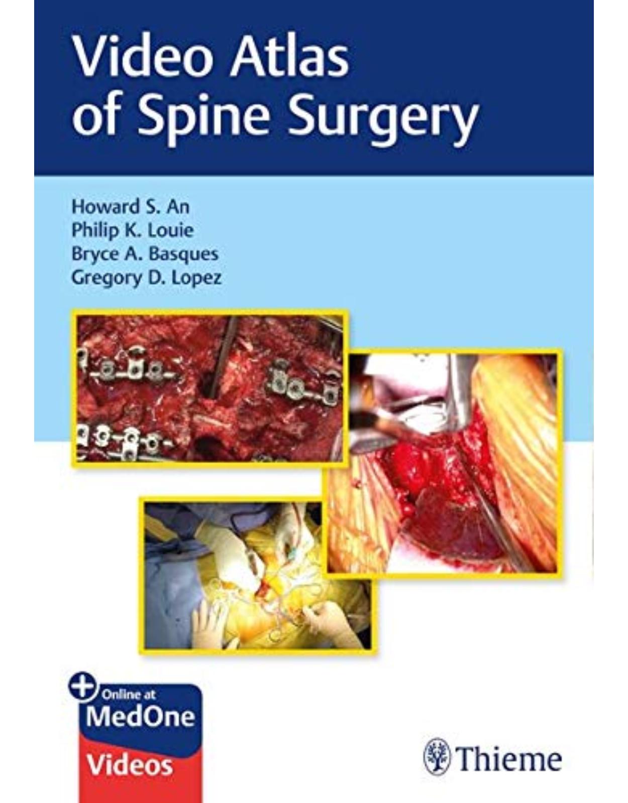 Video Atlas of Spine Surgery