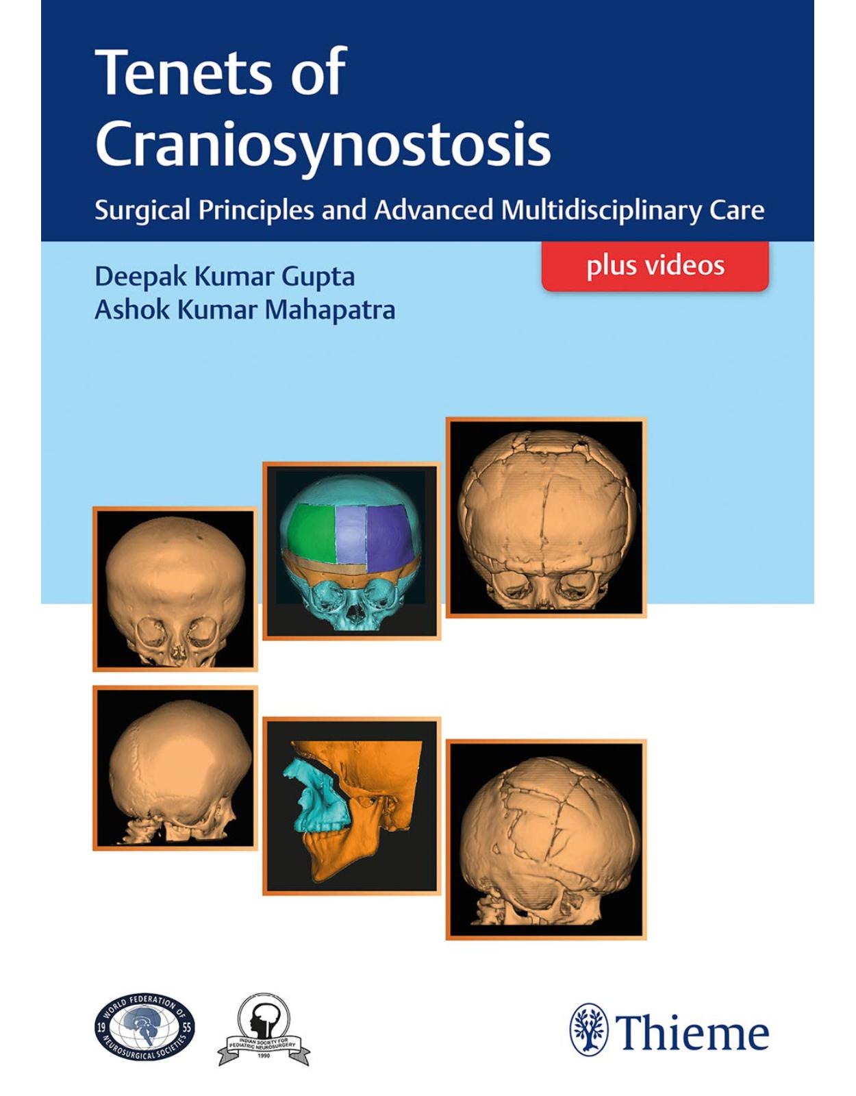 Tenets of Craniosynostosis: Surgical Principles and Advanced Multidisciplinary Care