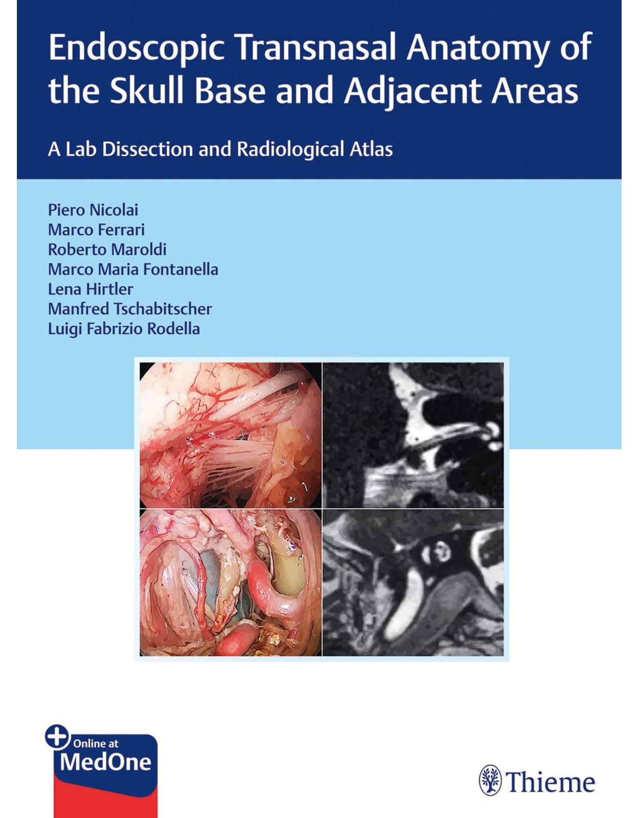Endoscopic Transnasal Anatomy of the Skull Base and Adjacent Areas: A Lab Dissection and Radiological Atlas