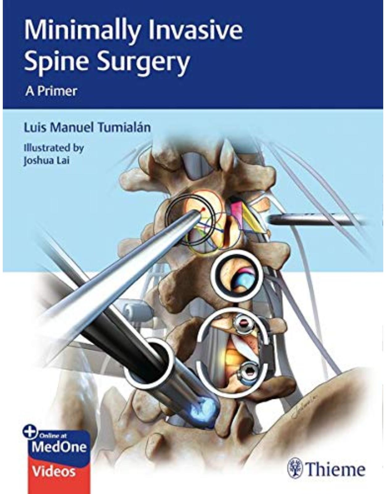 Minimally Invasive Spine Surgery: A Primer