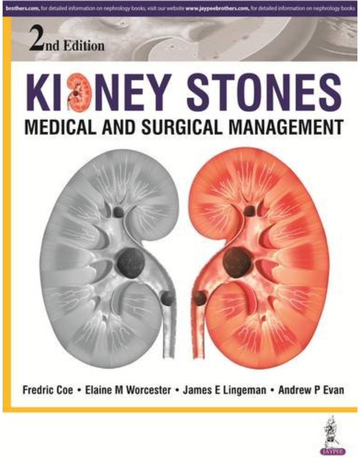 Kidney Stones: Medical and Surgical Management