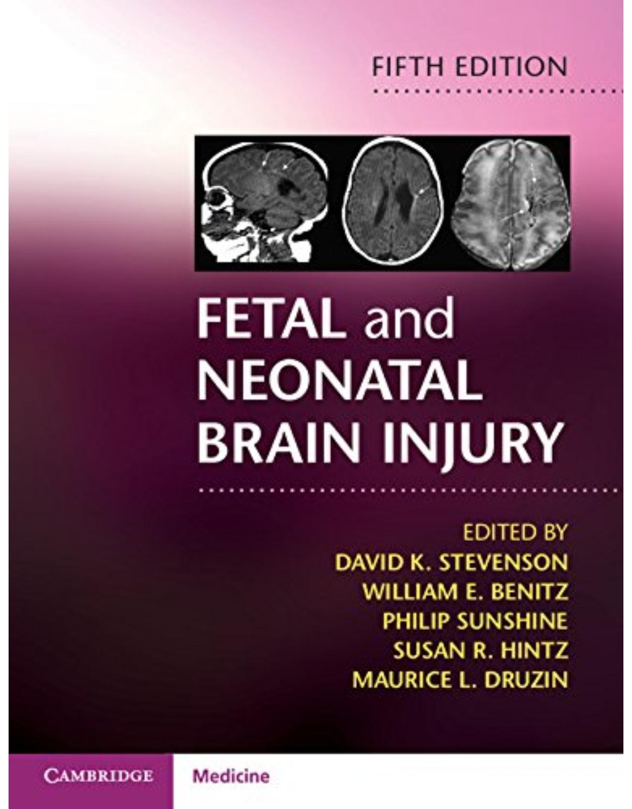 Fetal and Neonatal Brain Injury