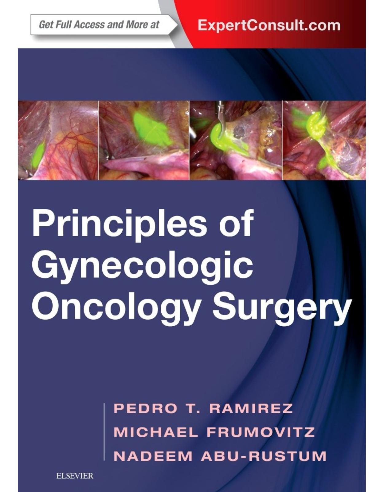 Principles of Gynecologic Oncology Surgery, 1e