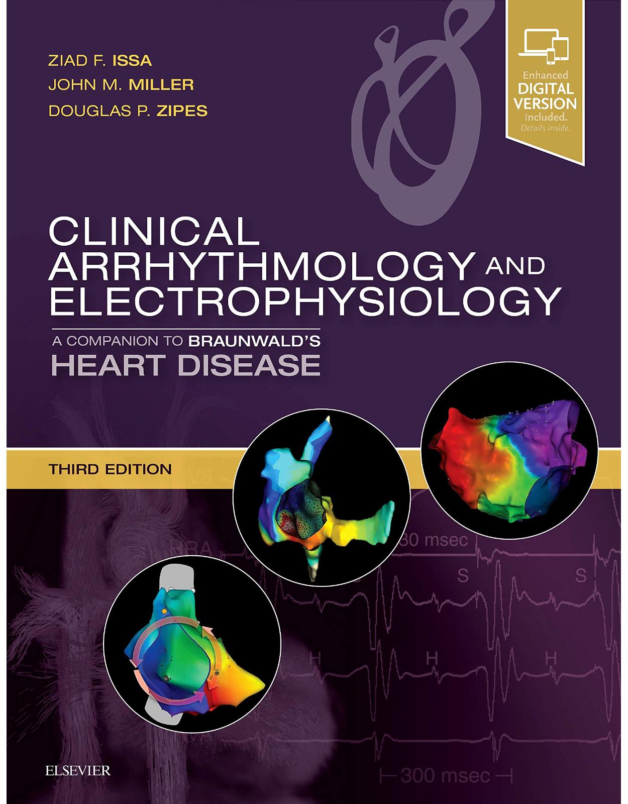 Clinical Arrhythmology and Electrophysiology: A Companion to Braunwald's Heart Disease, 3e