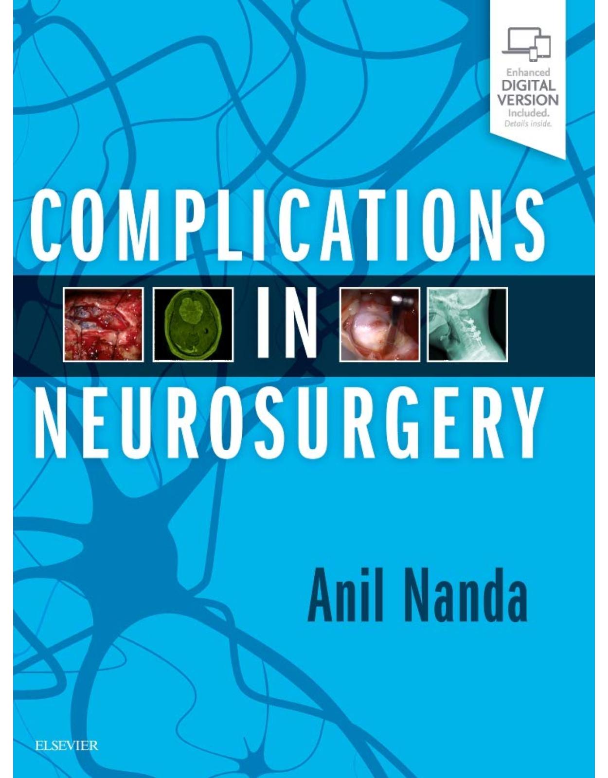 Complications in Neurosurgery, 1e�
