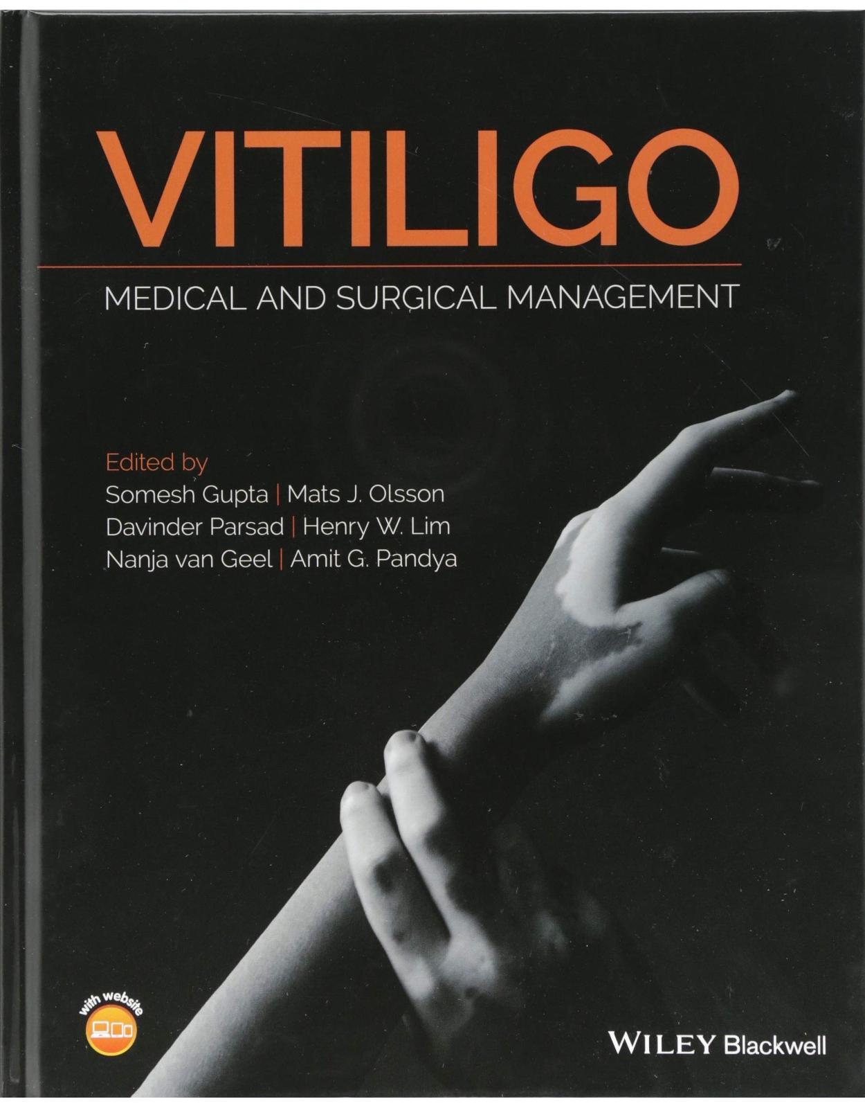 Vitiligo: Medical and Surgical Management