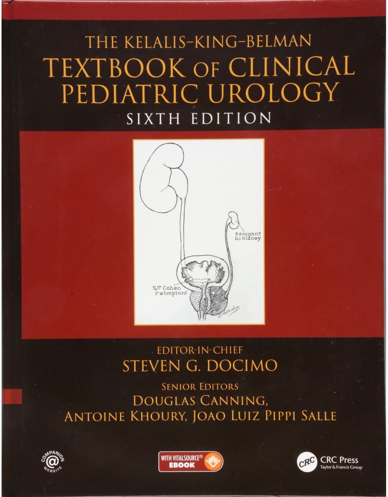 The Kelalis--King--Belman Textbook of Clinical Pediatric Urology