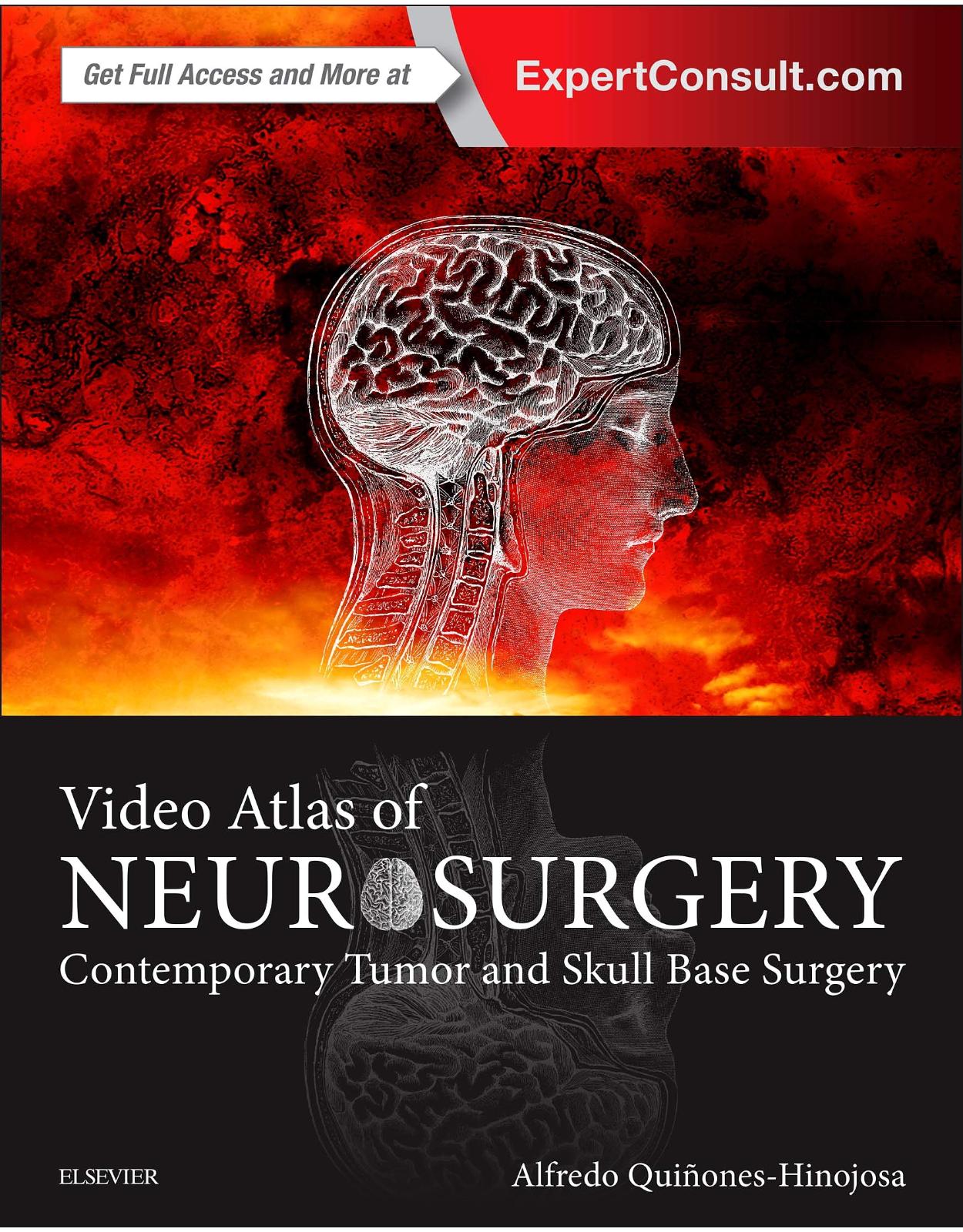 Video Atlas of Neurosurgery: Contemporary Tumor and Skull Base Surgery, 1e