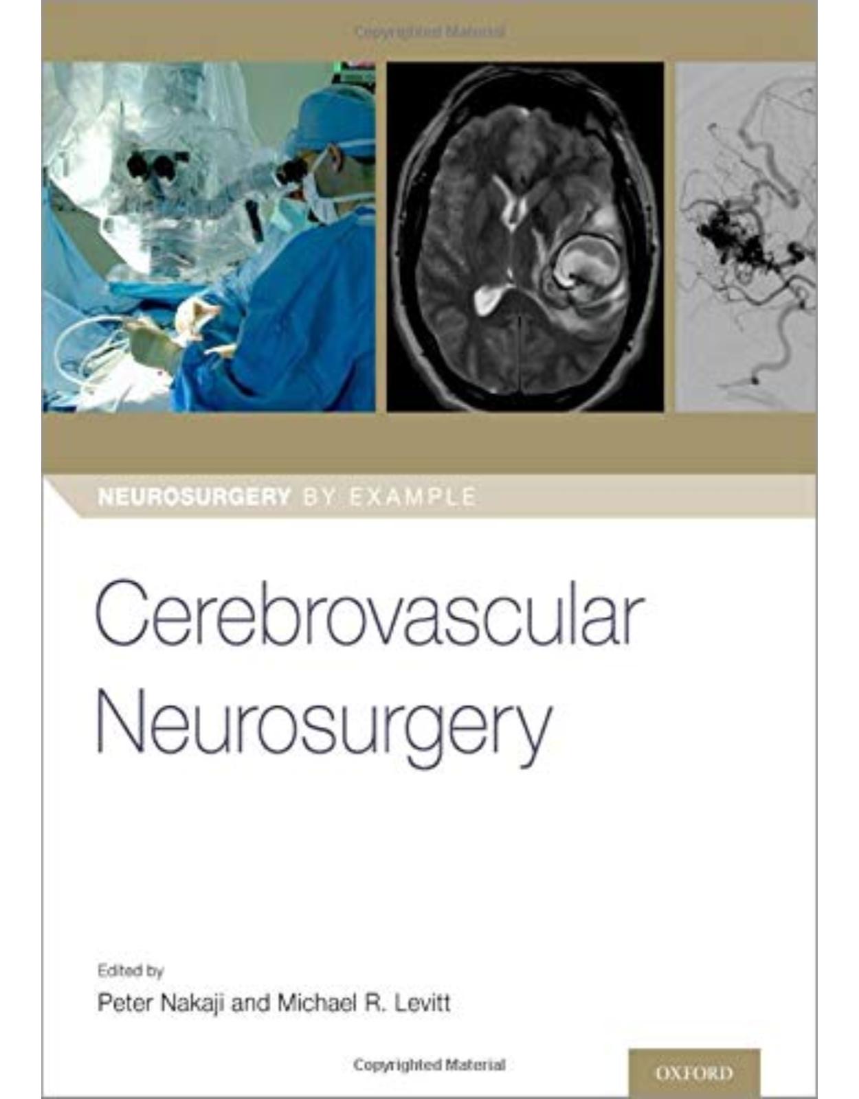 Cerebrovascular Neurosurgery